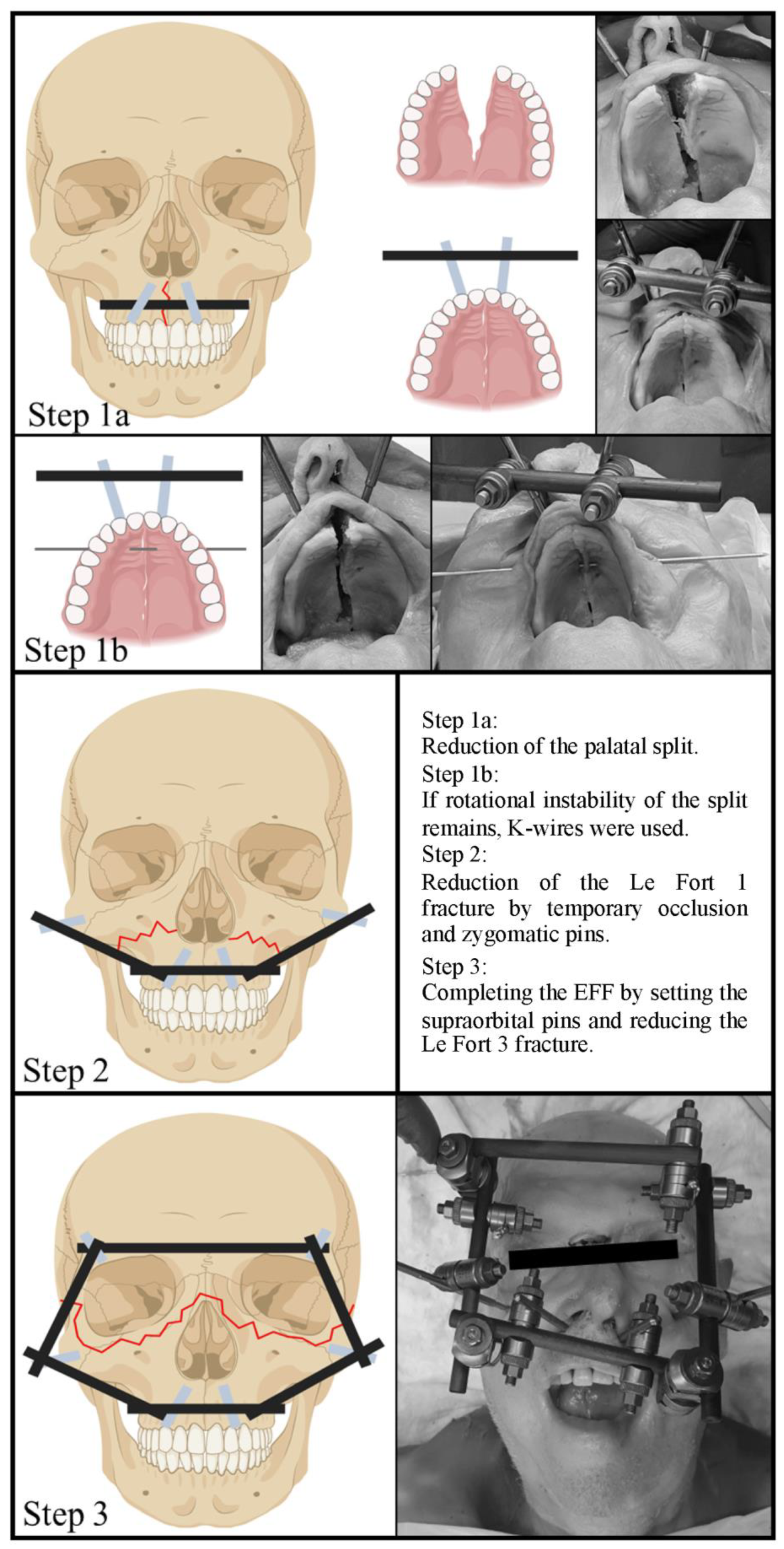Bioengineering 11 00279 g001