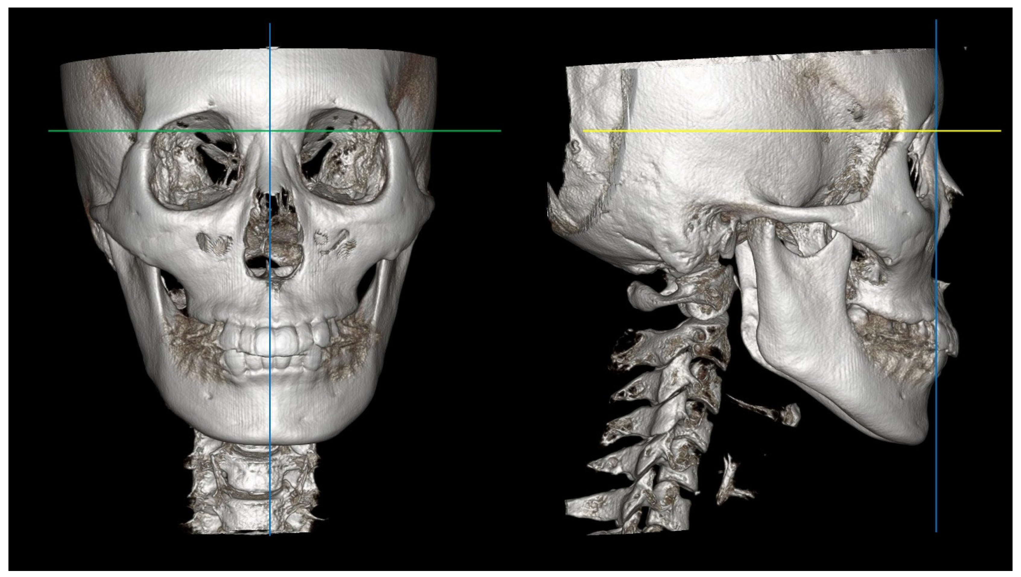 Bioengineering 11 00318 g002