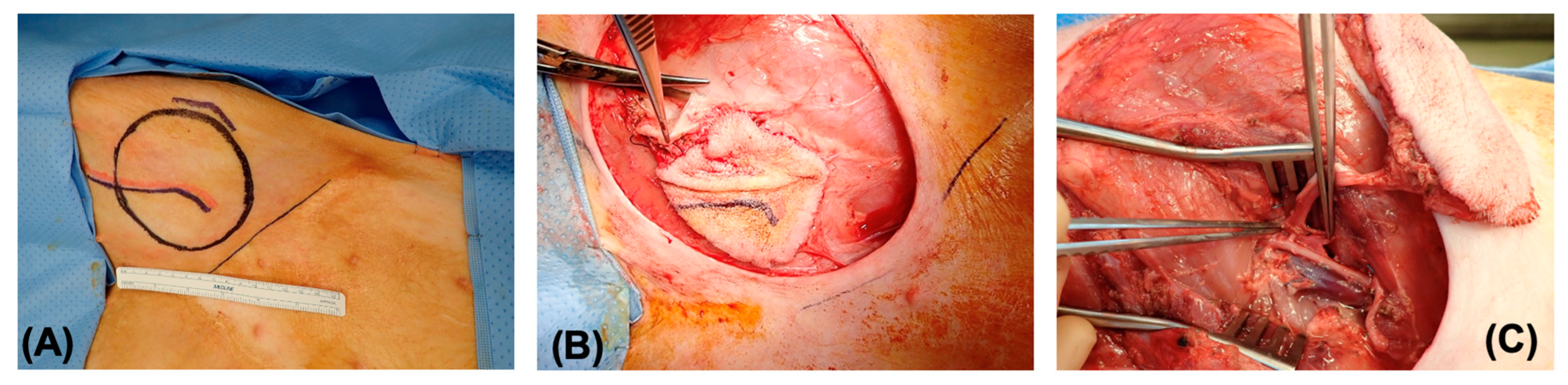 Bioengineering 11 00321 g001