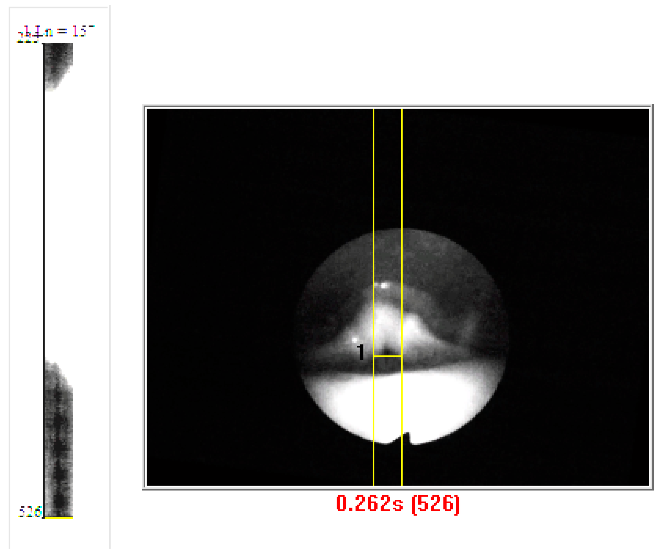 Bioengineering 11 00334 g008