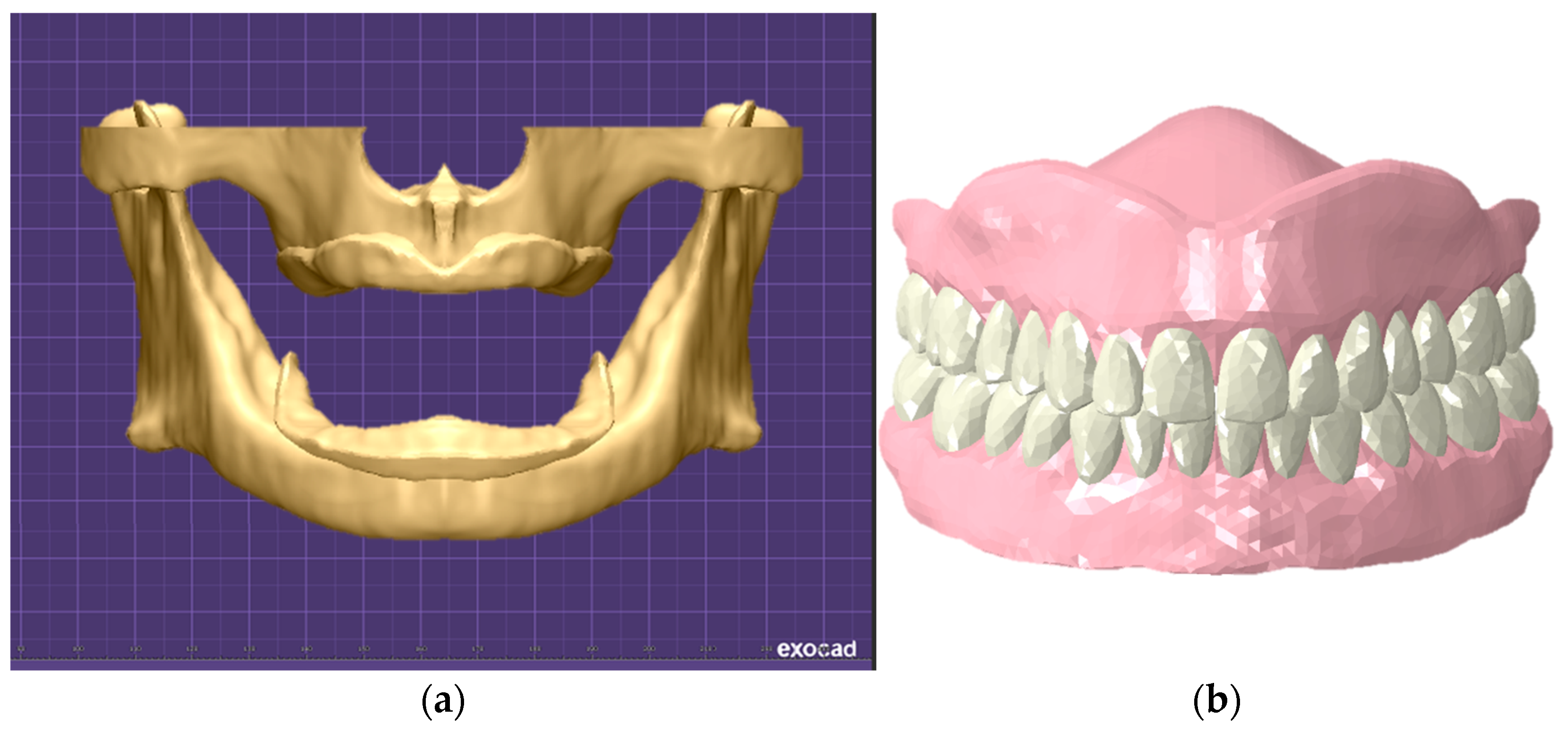 Bioengineering 11 00336 g002
