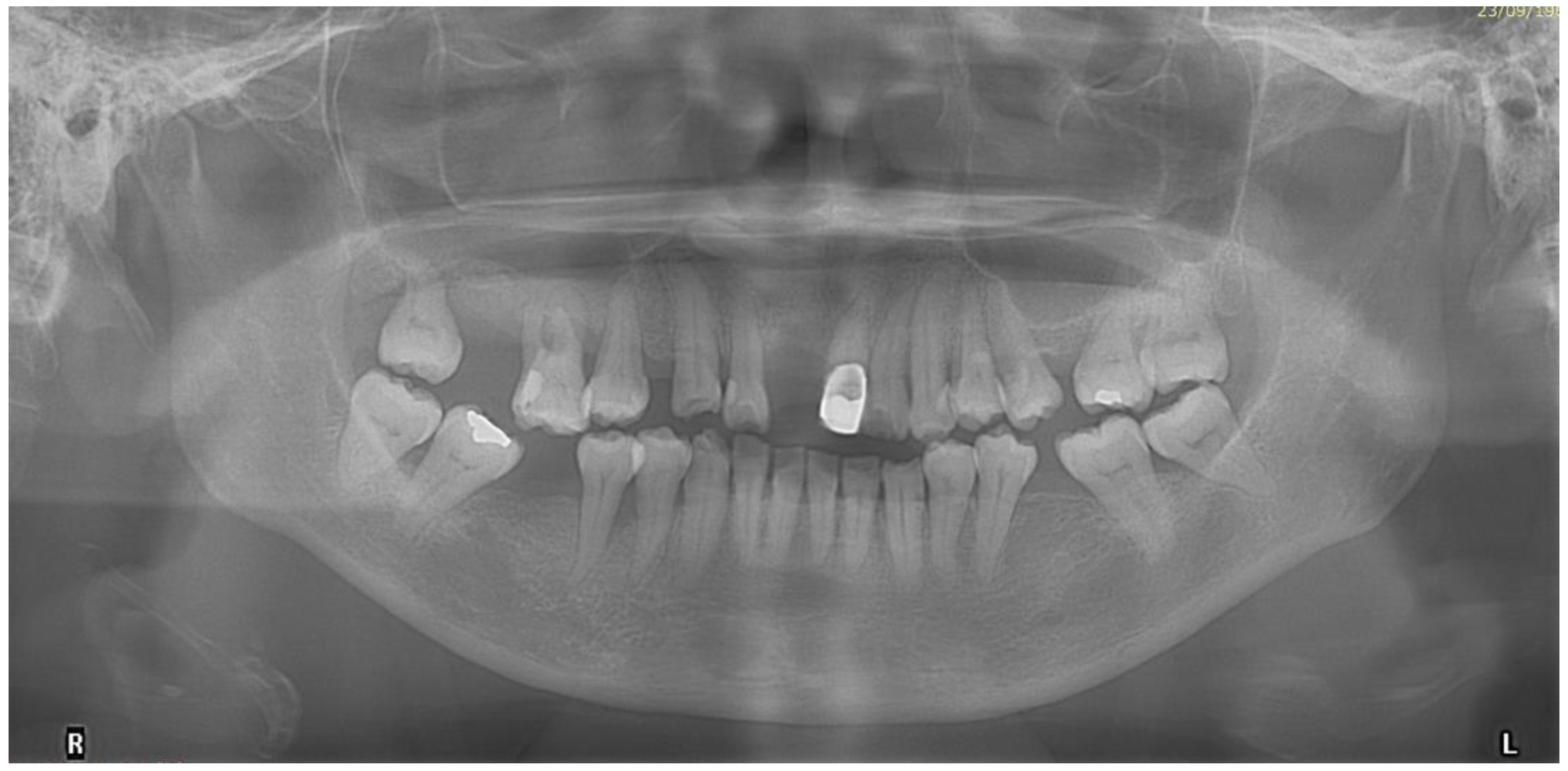 Bioengineering 11 00403 g003