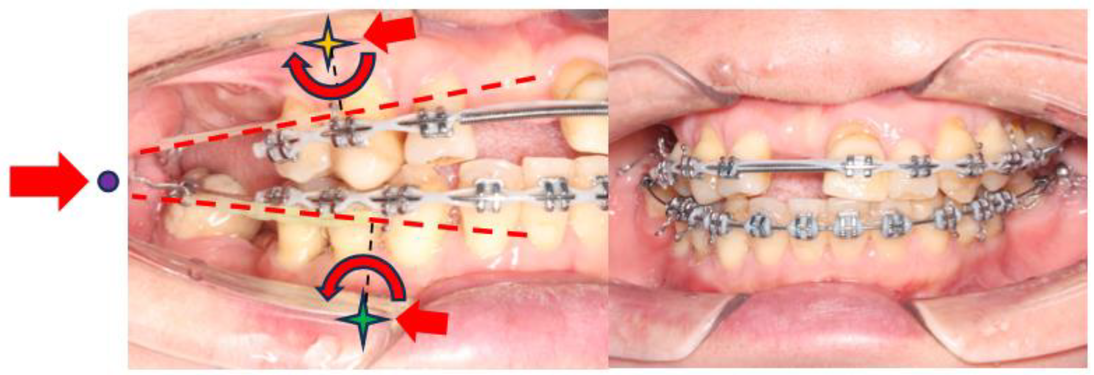 Bioengineering 11 00403 g009