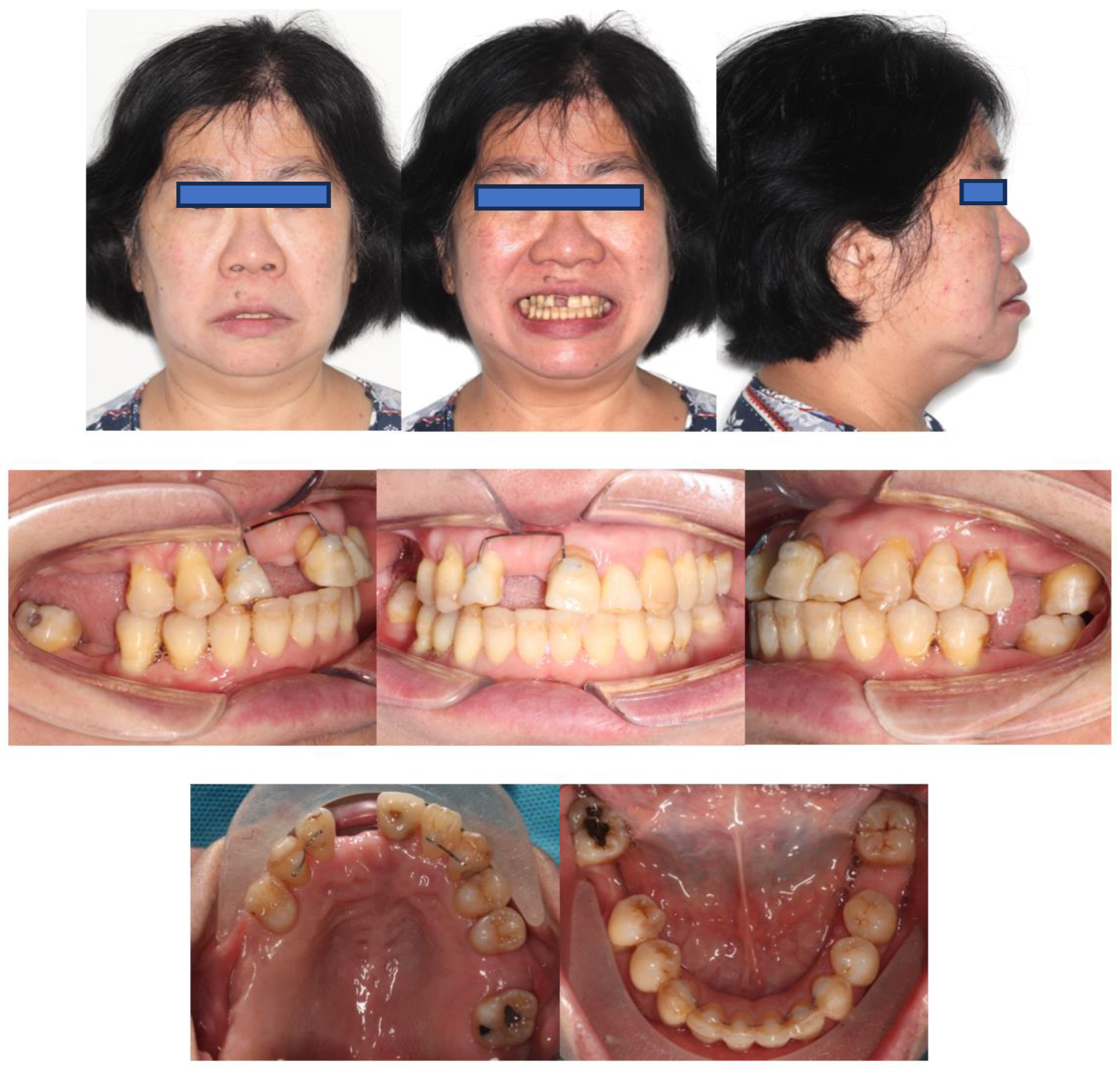 Bioengineering 11 00403 g011