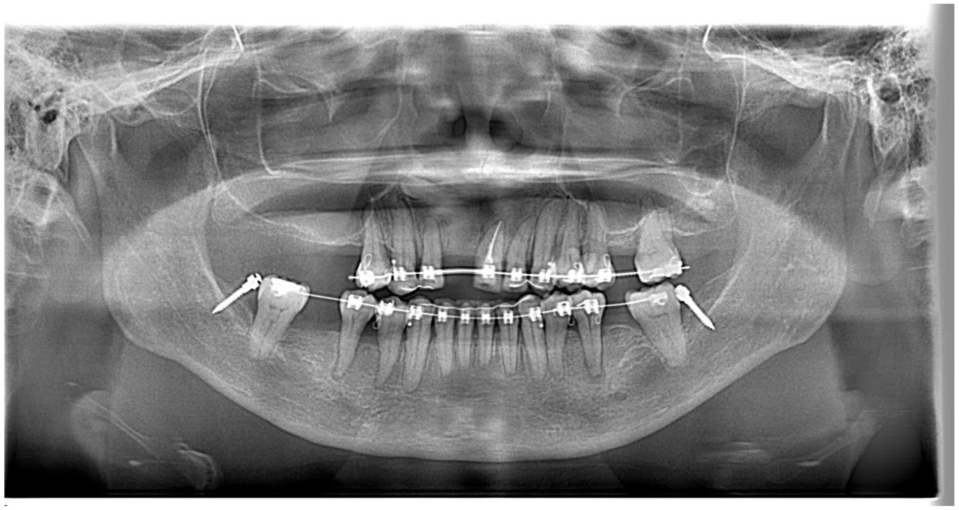 Bioengineering 11 00403 g012
