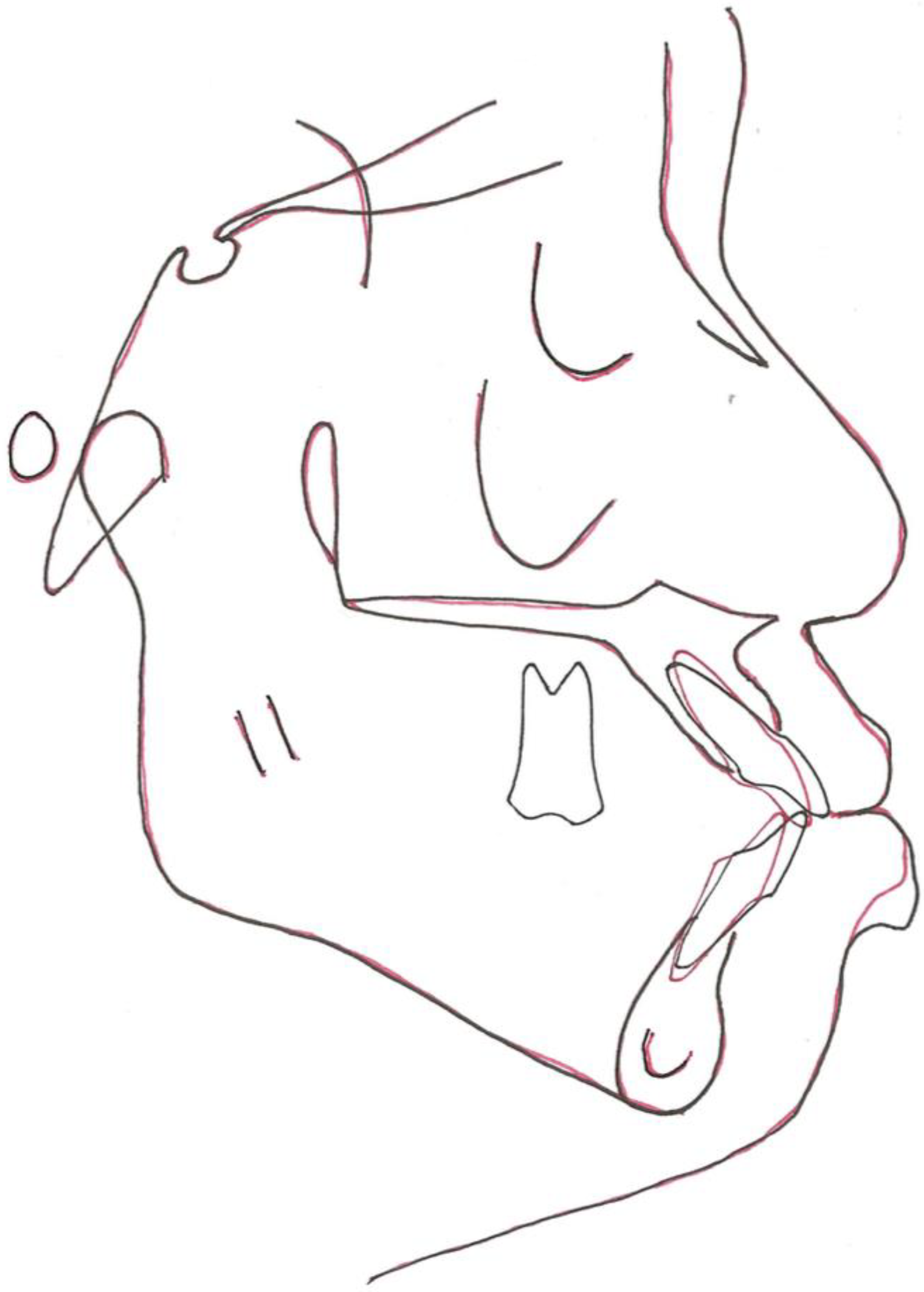 Bioengineering 11 00403 g014