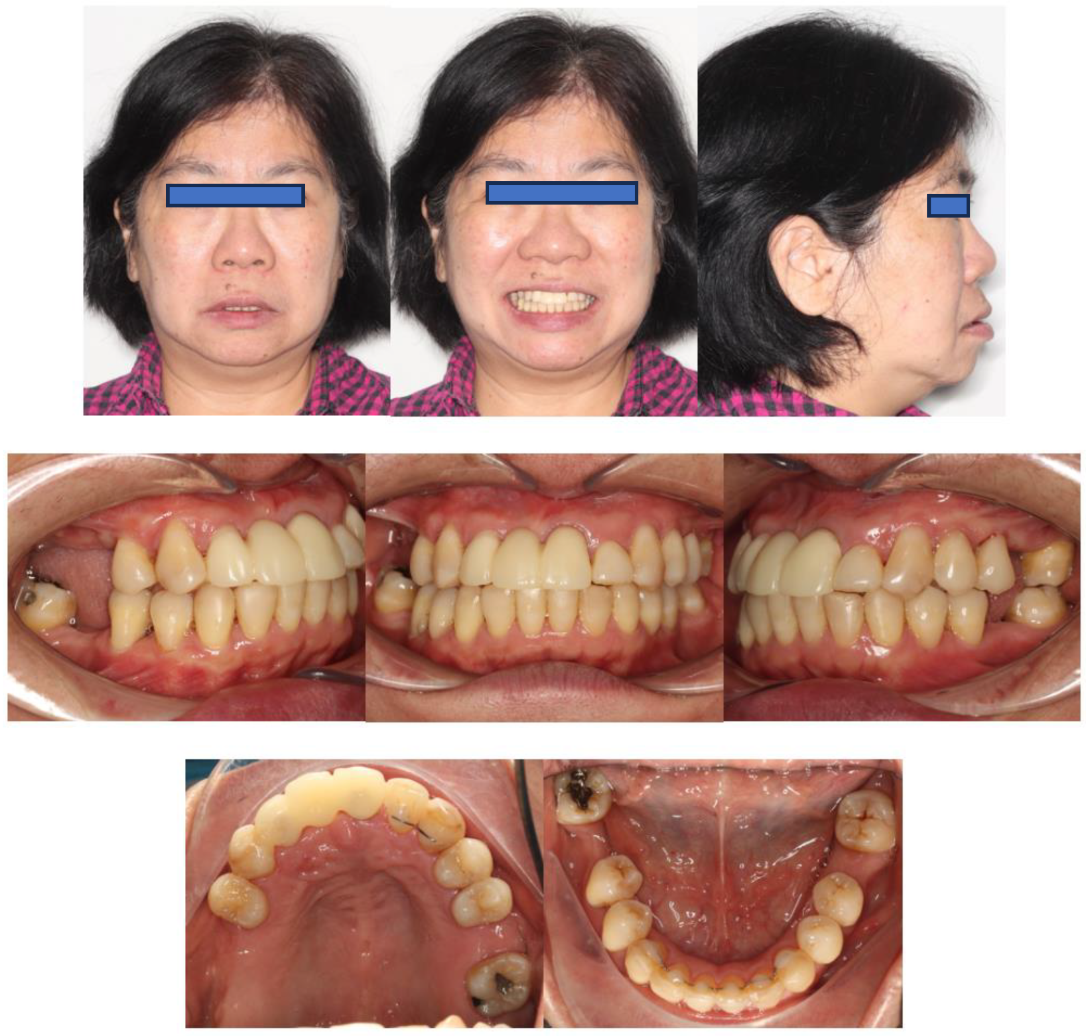 Bioengineering 11 00403 g015