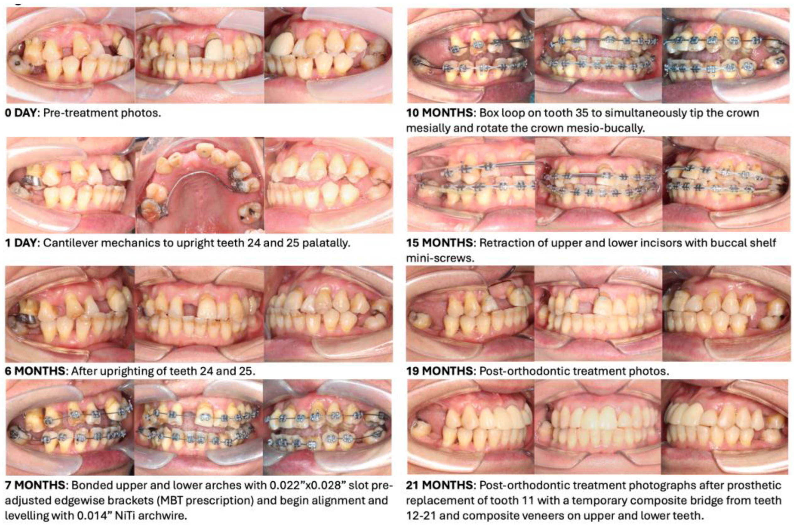 Bioengineering 11 00403 g017