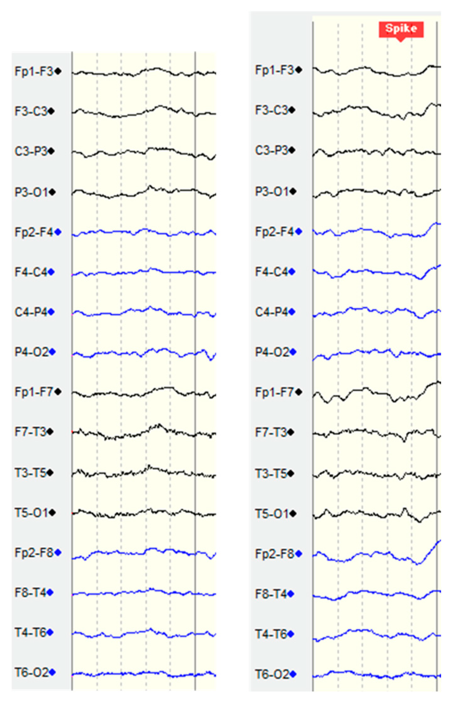 Bioengineering 11 00421 g005