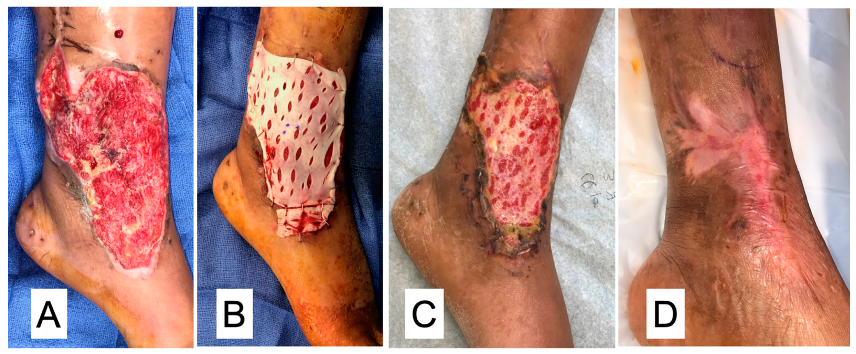 Bioengineering 11 00422 g004