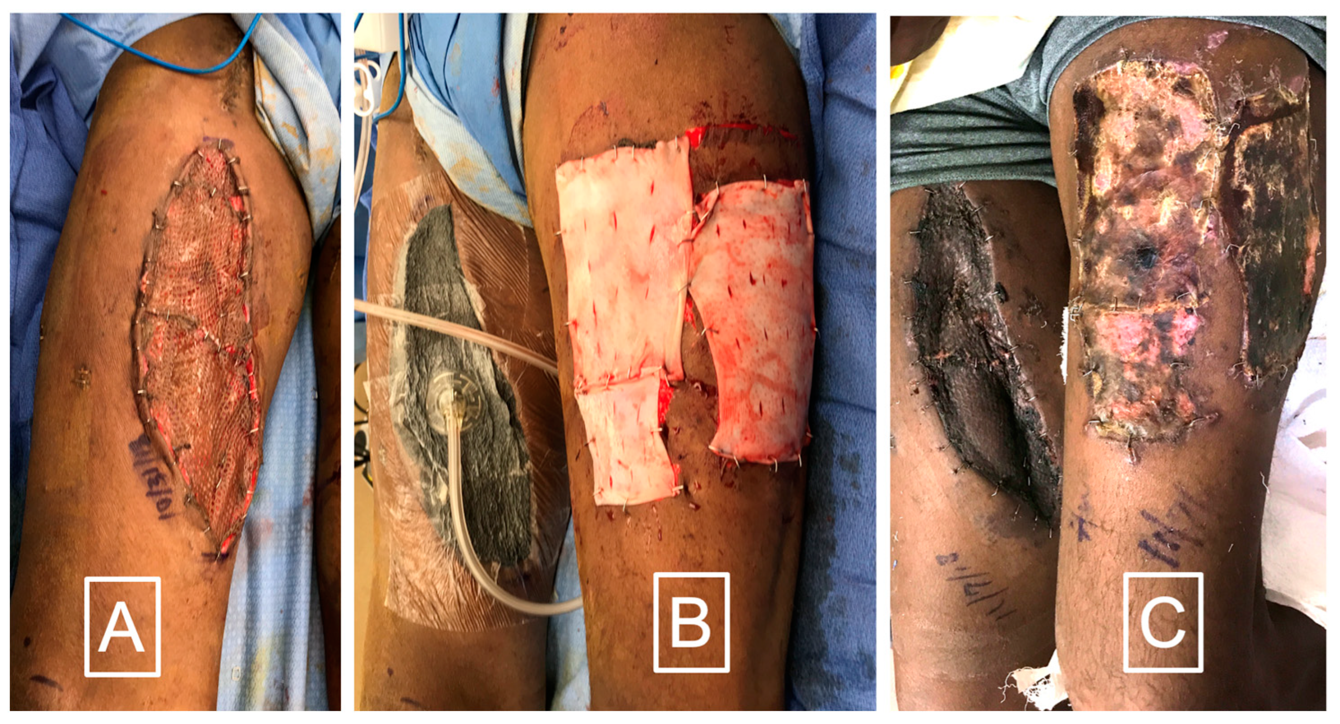 Bioengineering 11 00422 g005