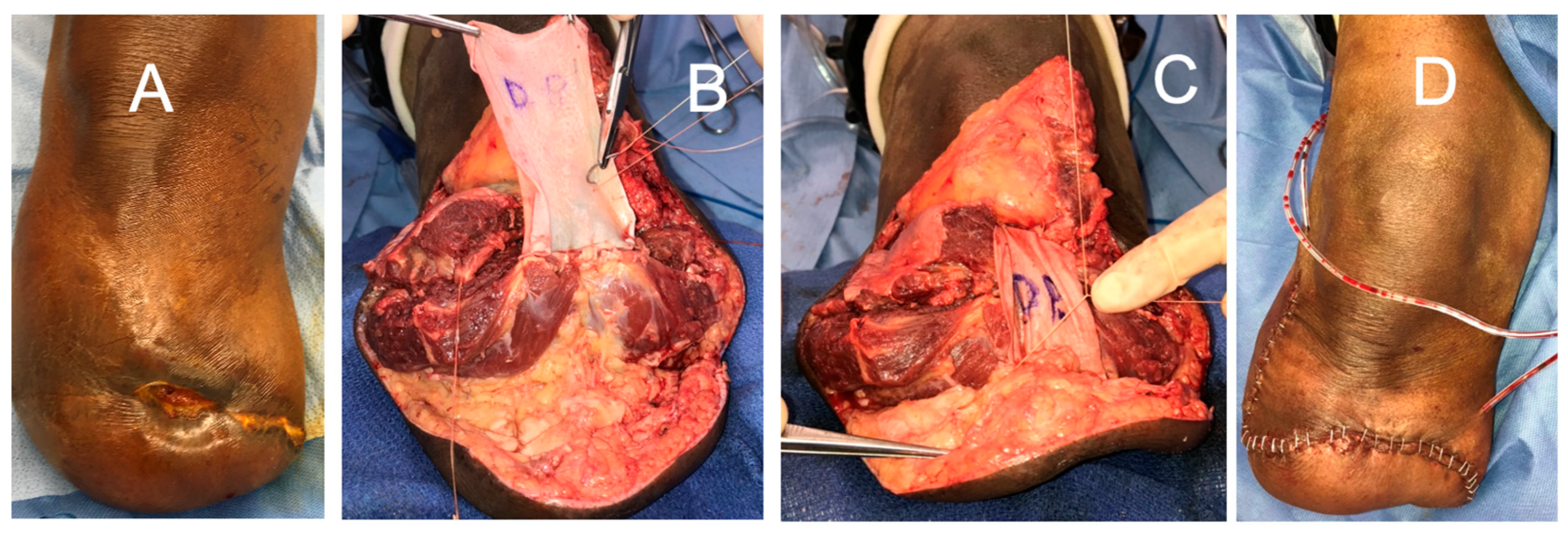 Bioengineering 11 00422 g010