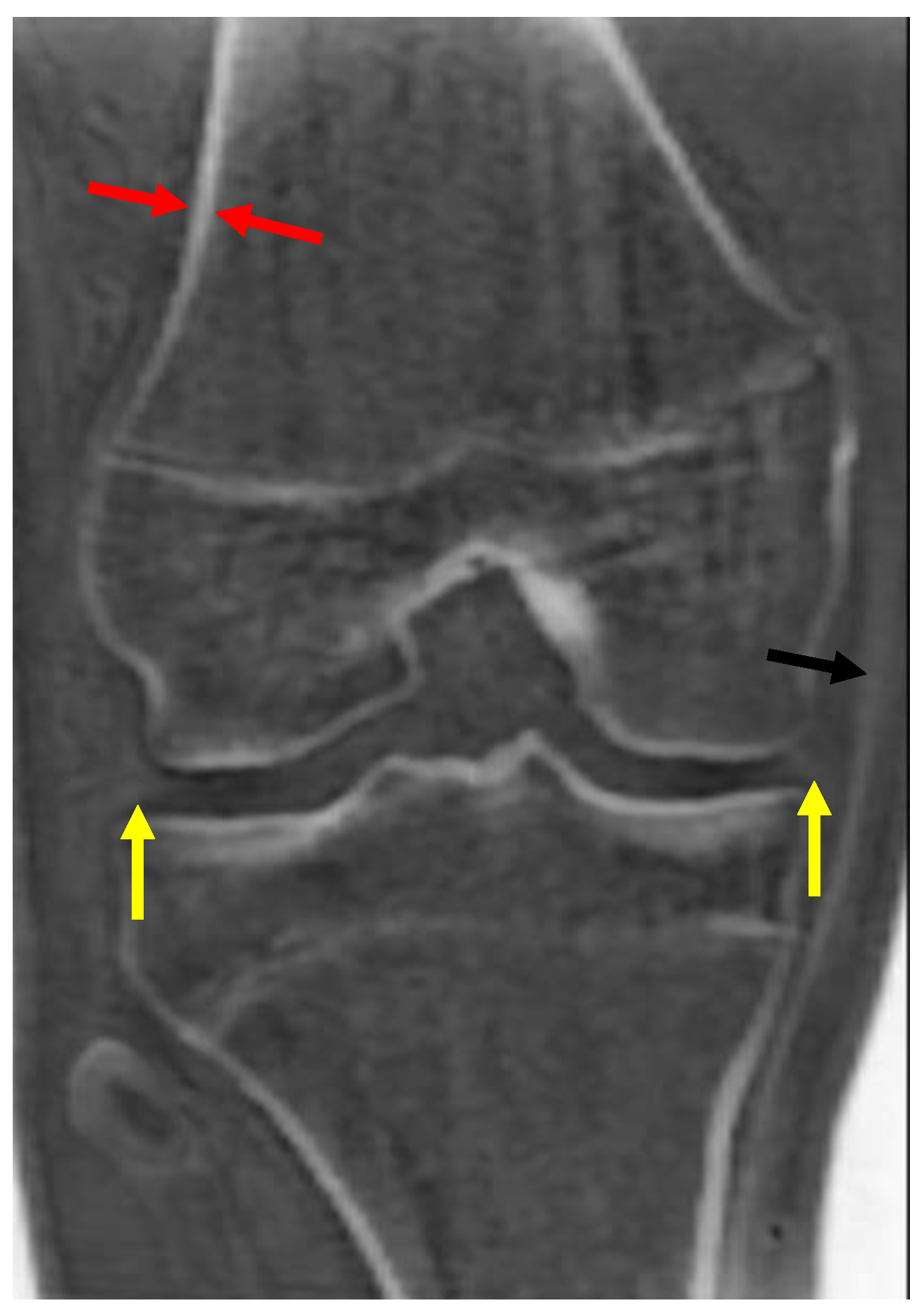 Bioengineering 11 00441 g001