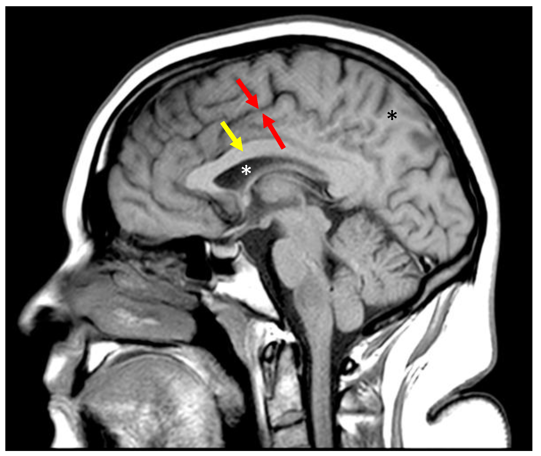 Bioengineering 11 00441 g004
