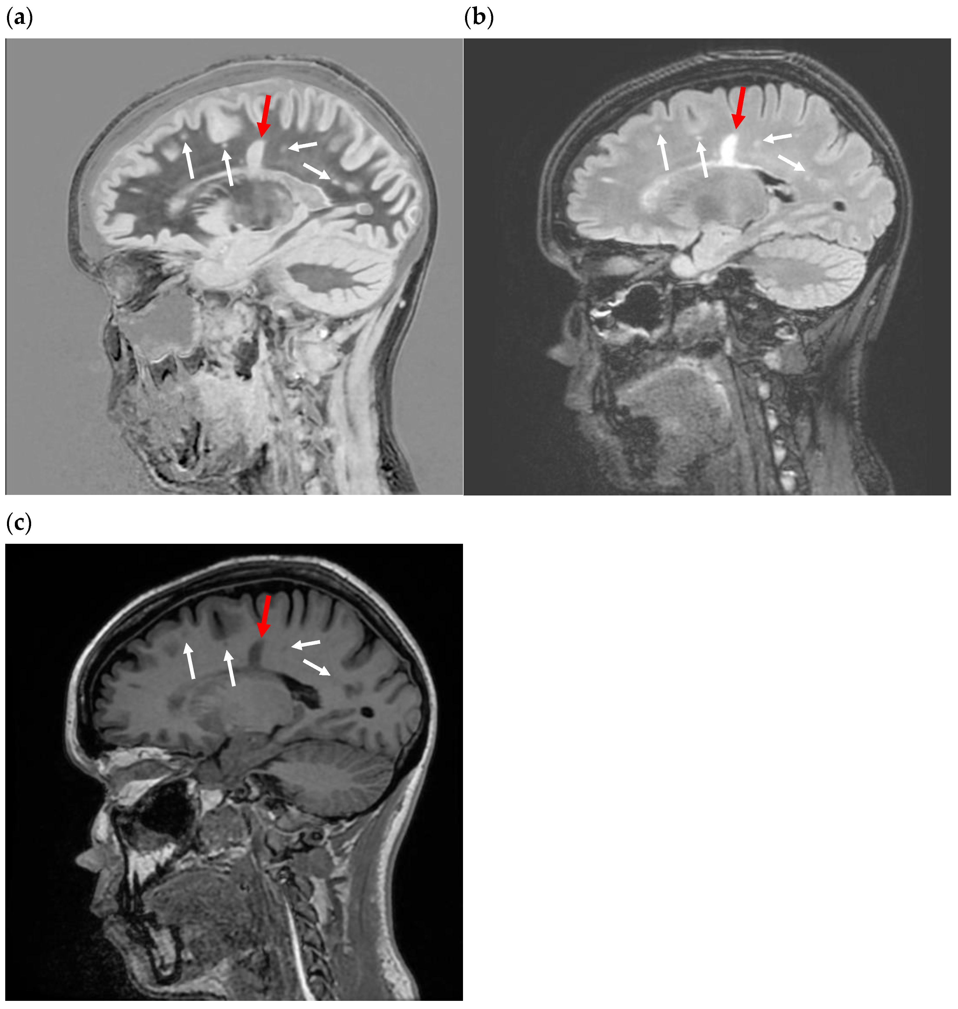 Bioengineering 11 00441 g007