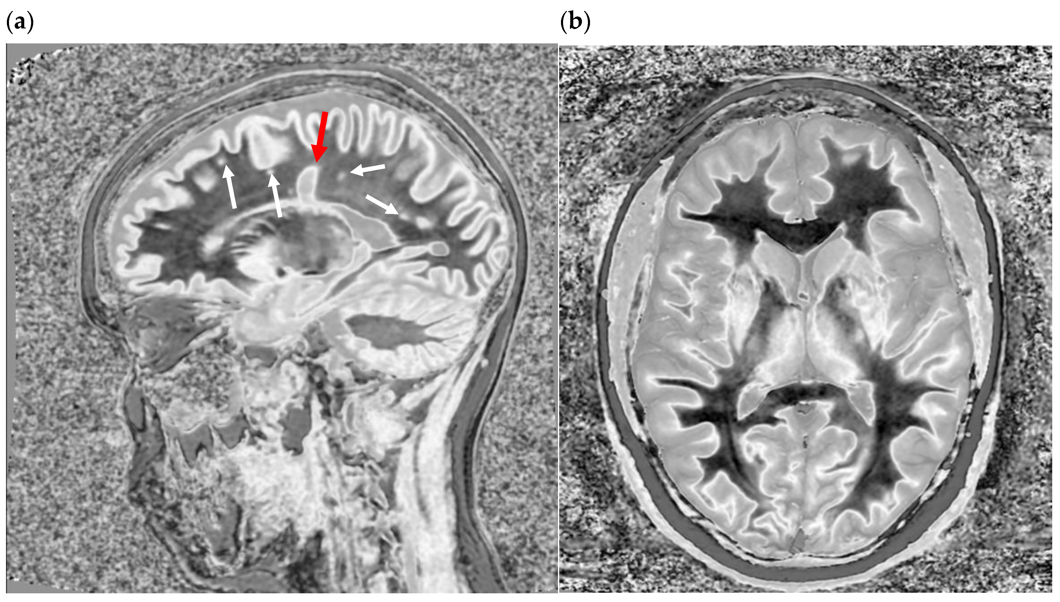 Bioengineering 11 00441 g009