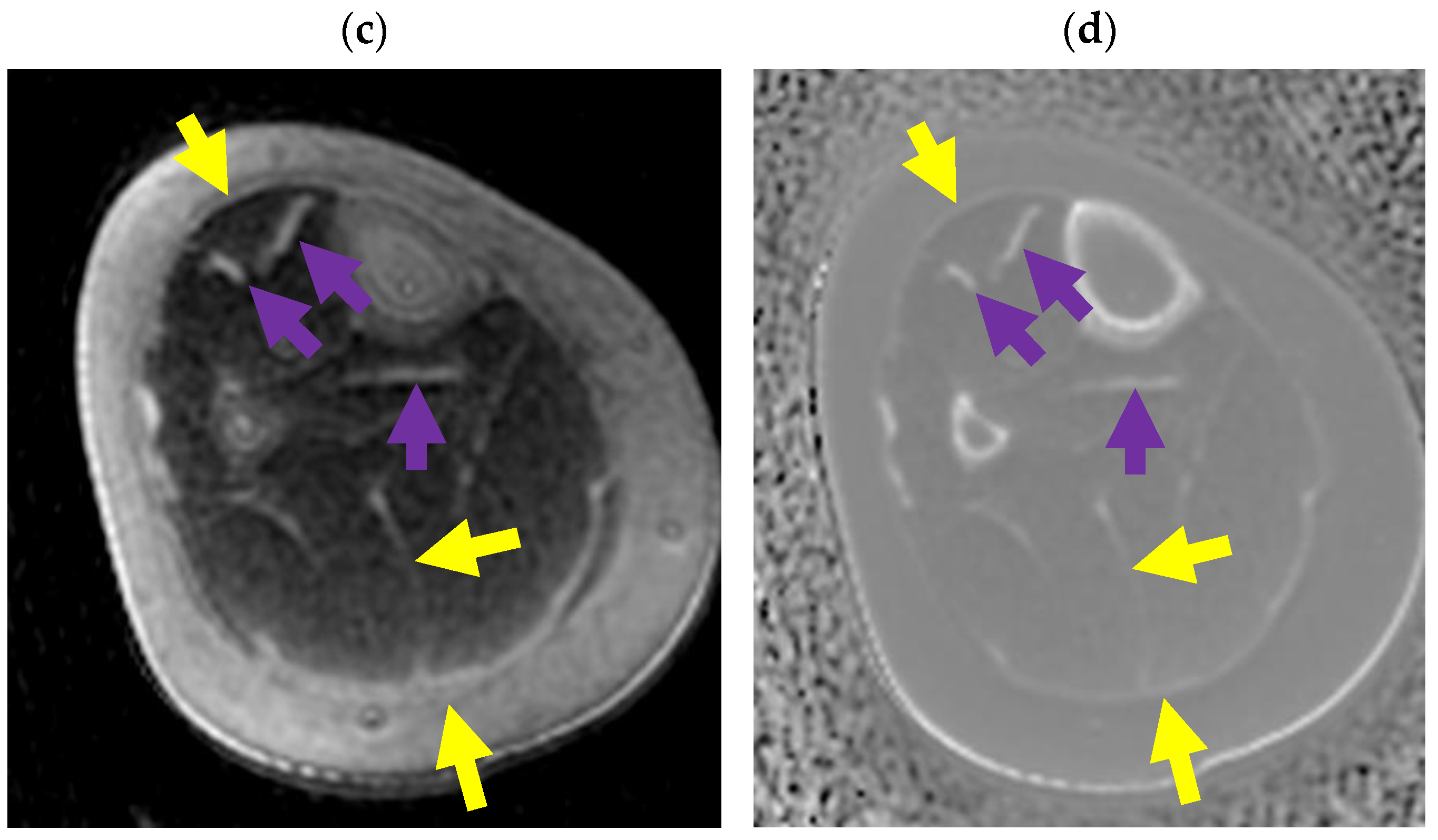 Bioengineering 11 00441 g021b