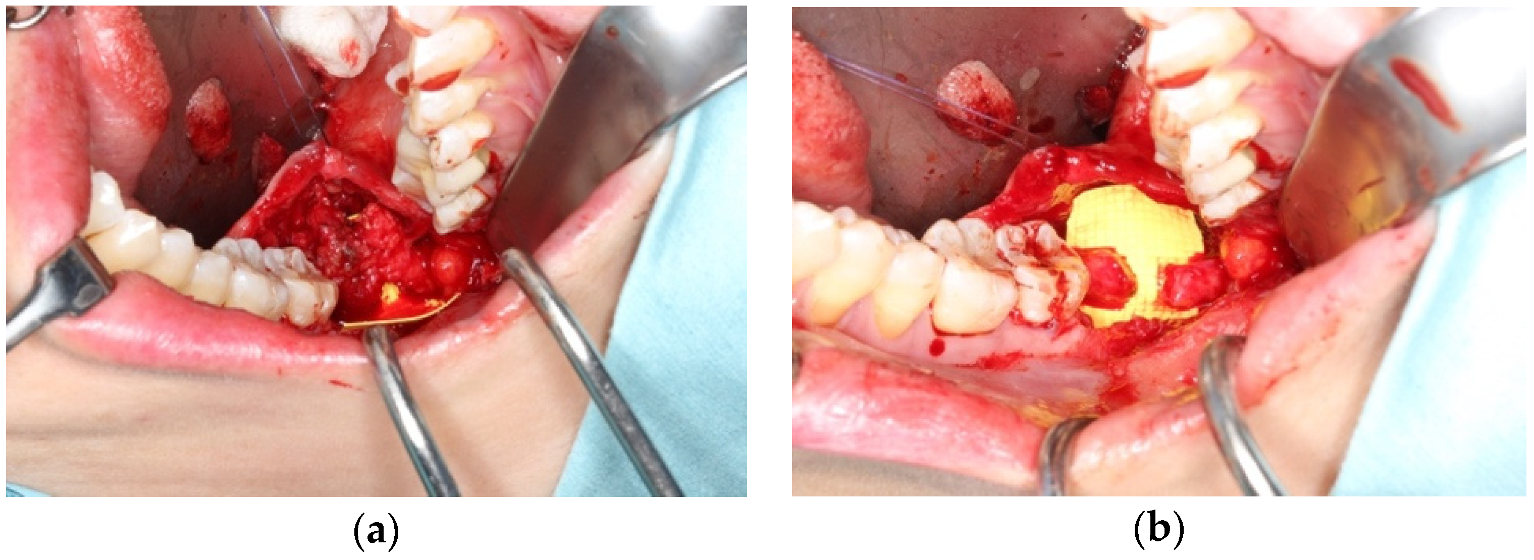 Bioengineering 11 00444 g001