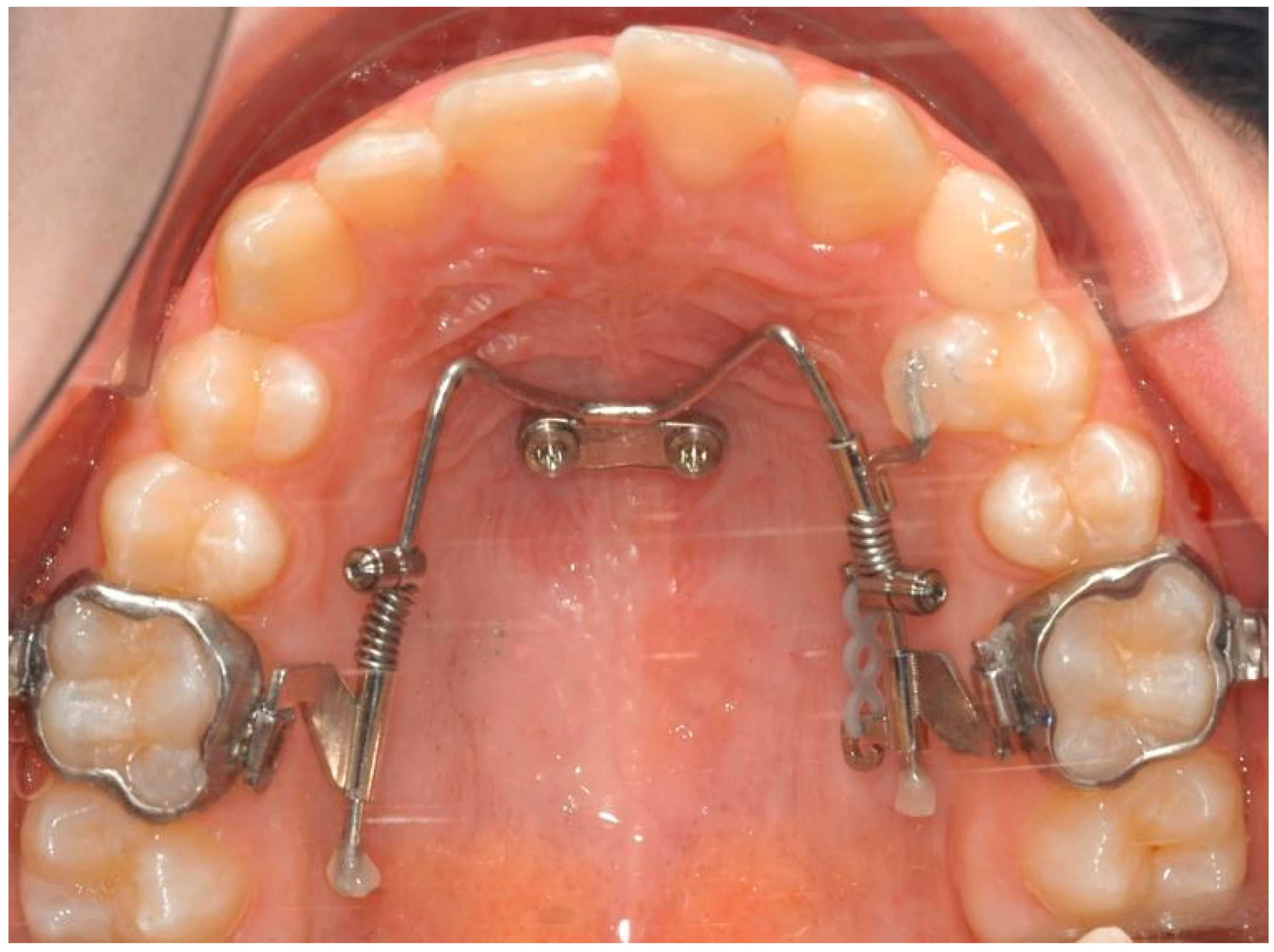 Bioengineering 11 00450 g001