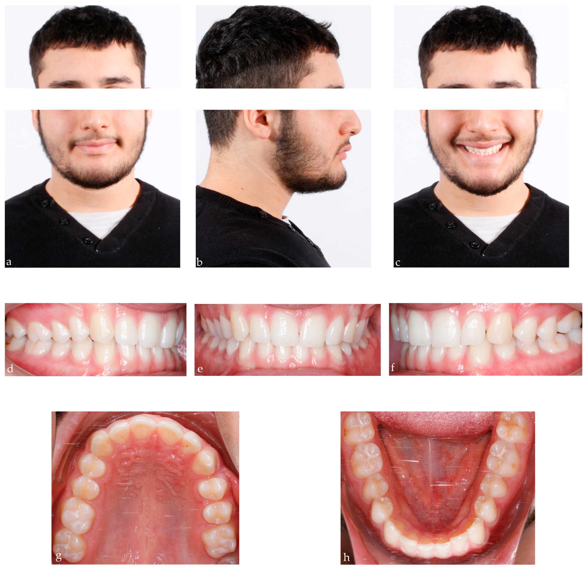 Bioengineering 11 00450 g004a