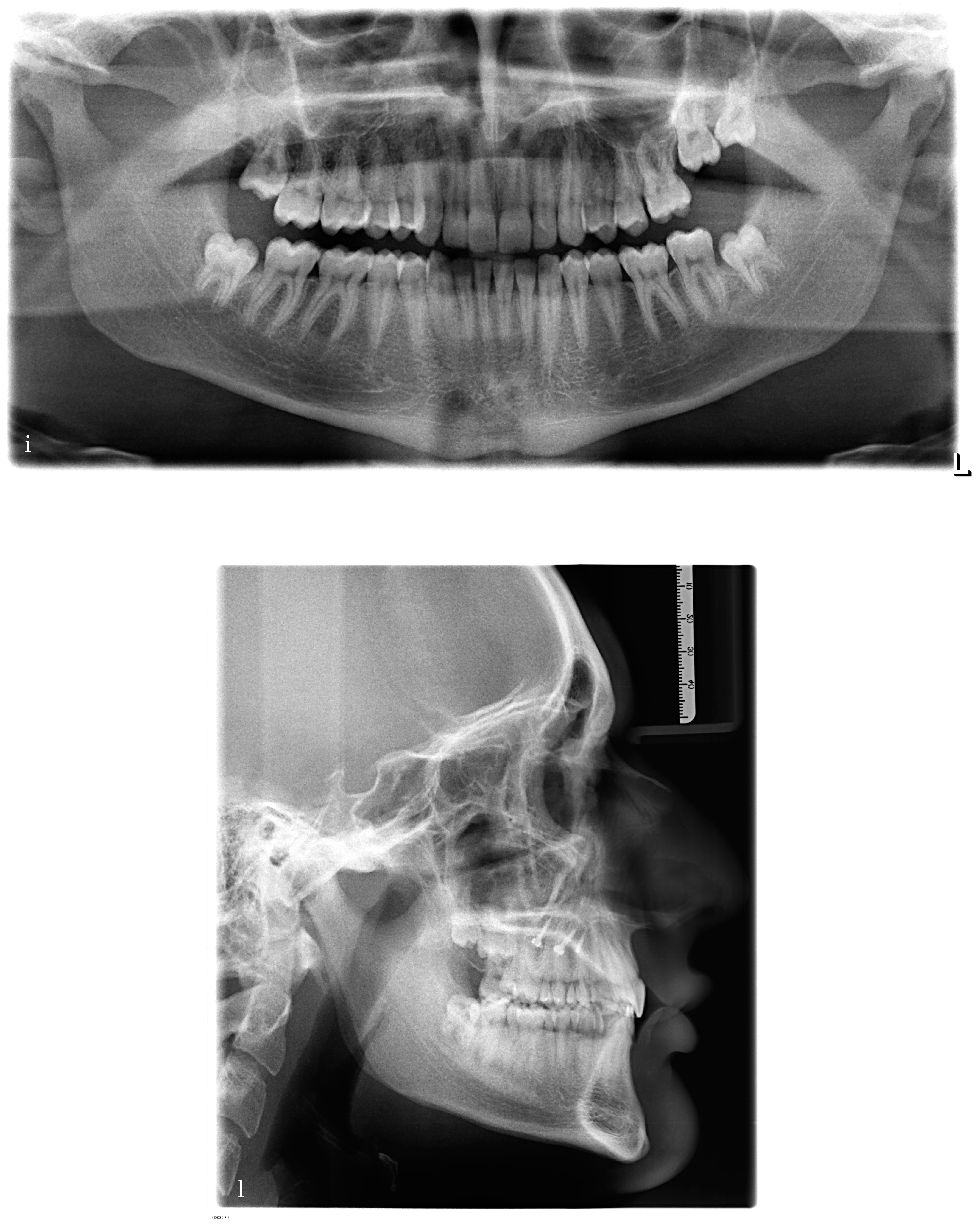 Bioengineering 11 00450 g004b