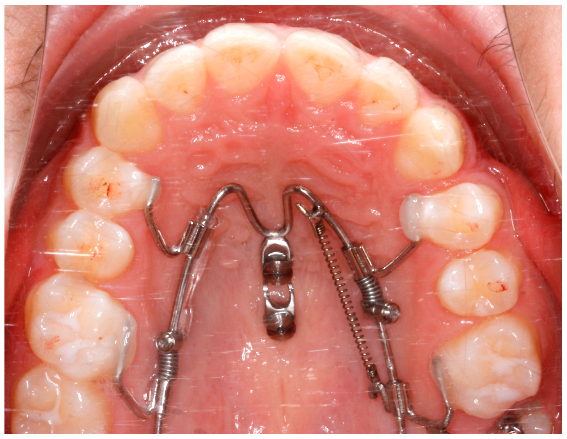 Bioengineering 11 00450 g005