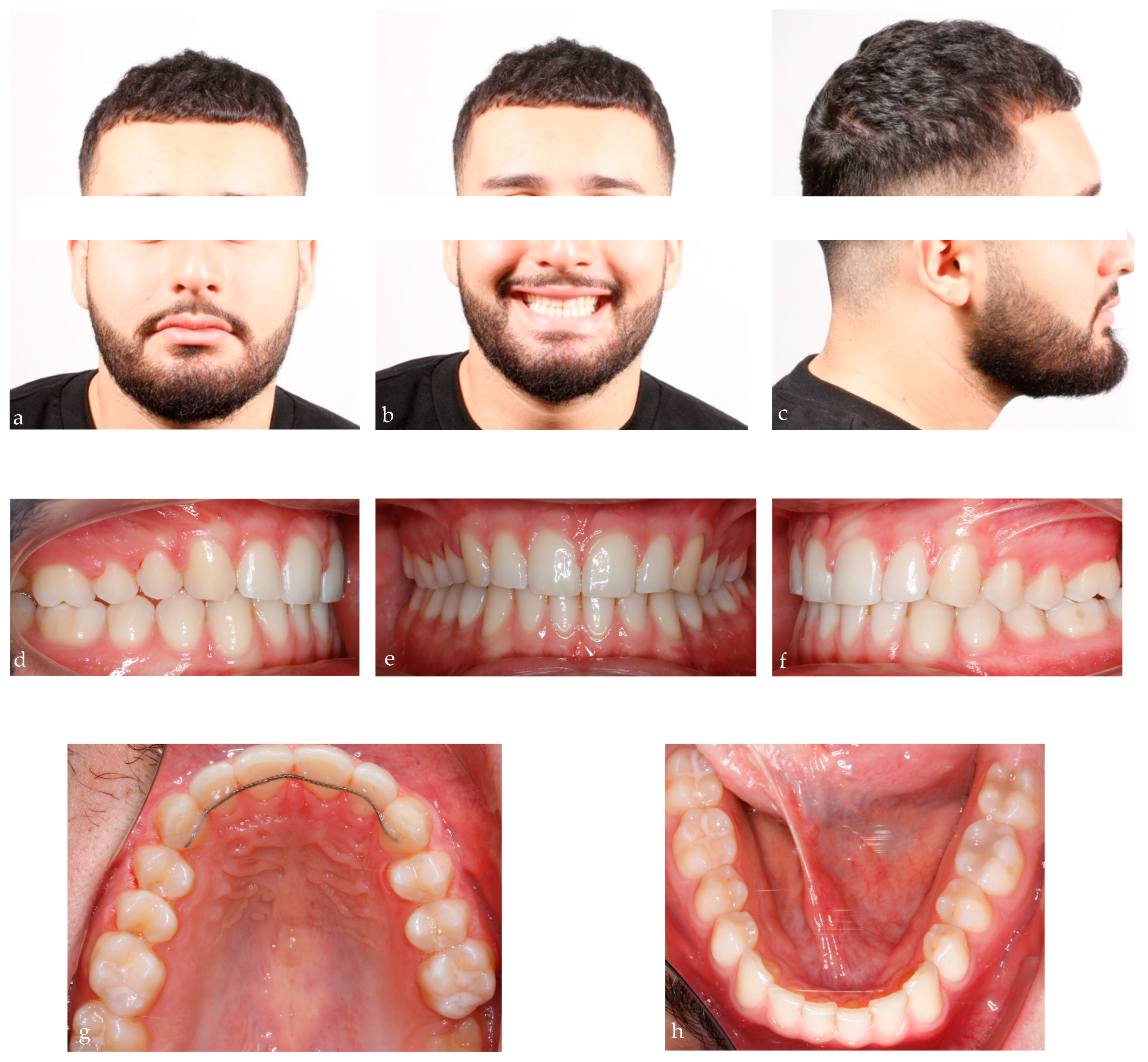 Bioengineering 11 00450 g007a