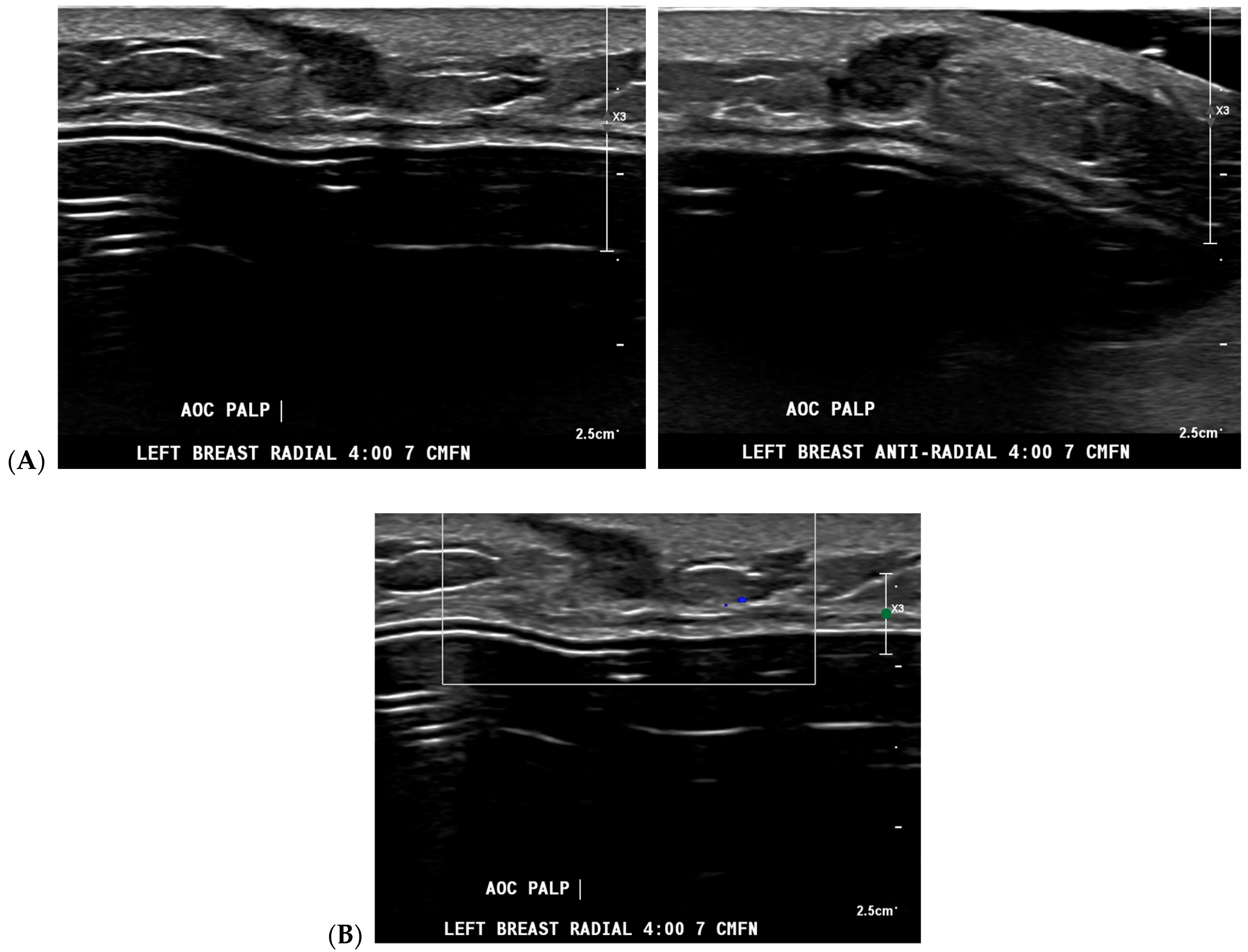 Bioengineering 11 00451 g003a