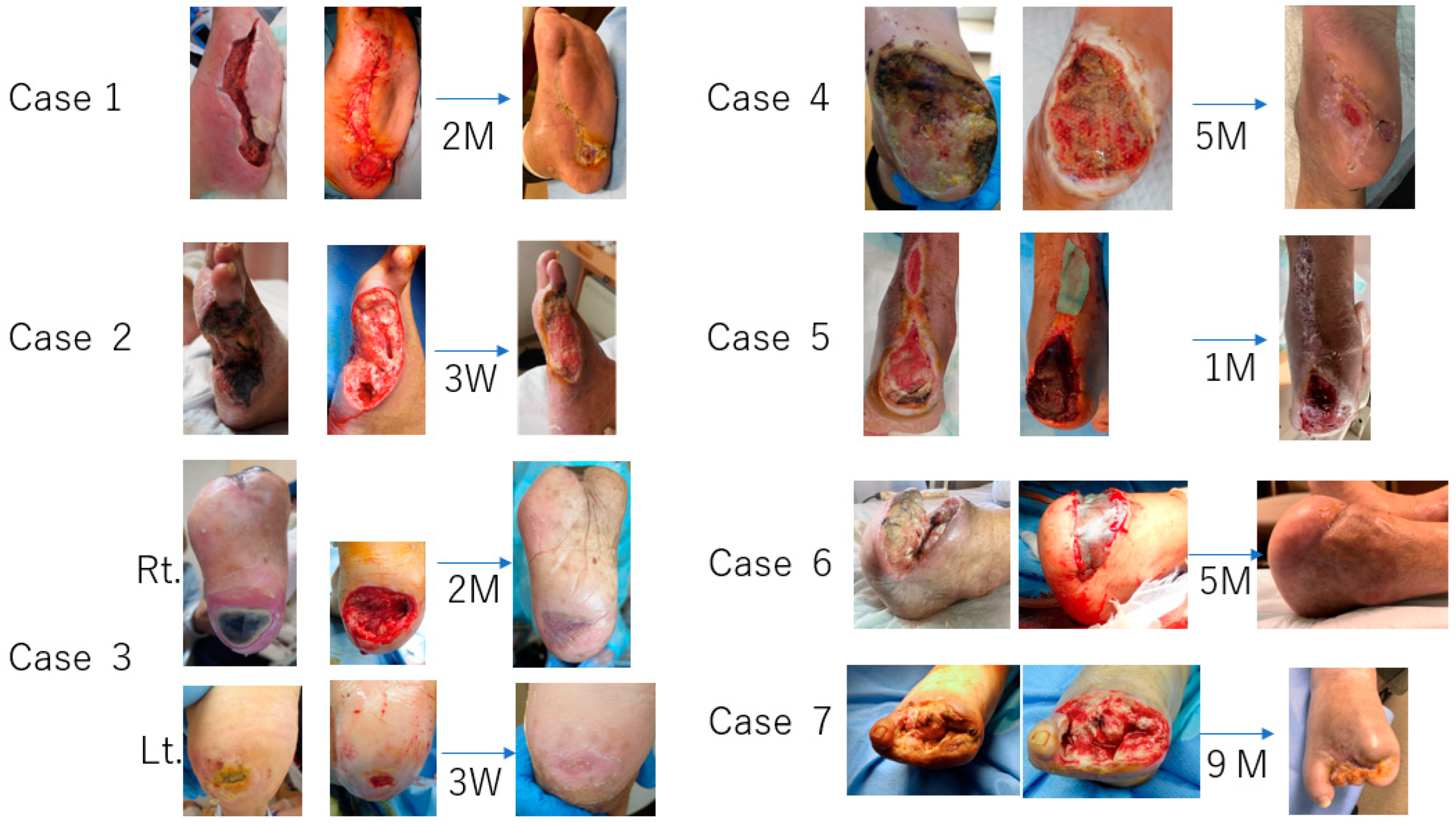 Bioengineering 11 00462 g007