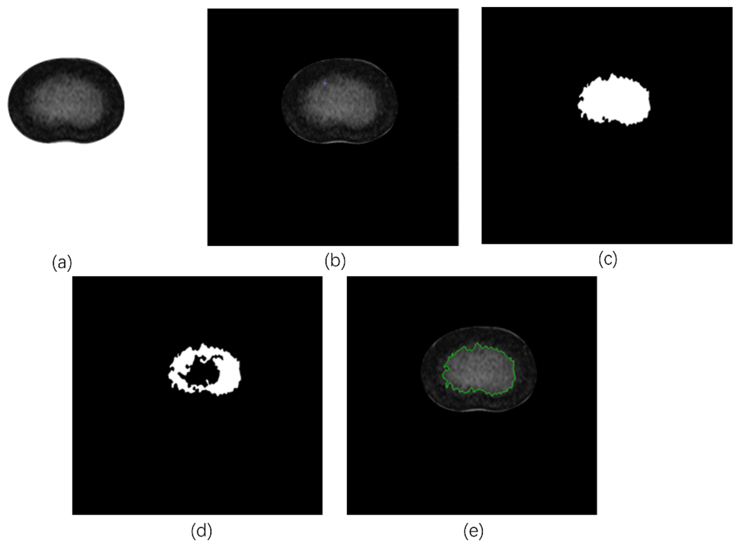 Bioengineering 11 00466 g004