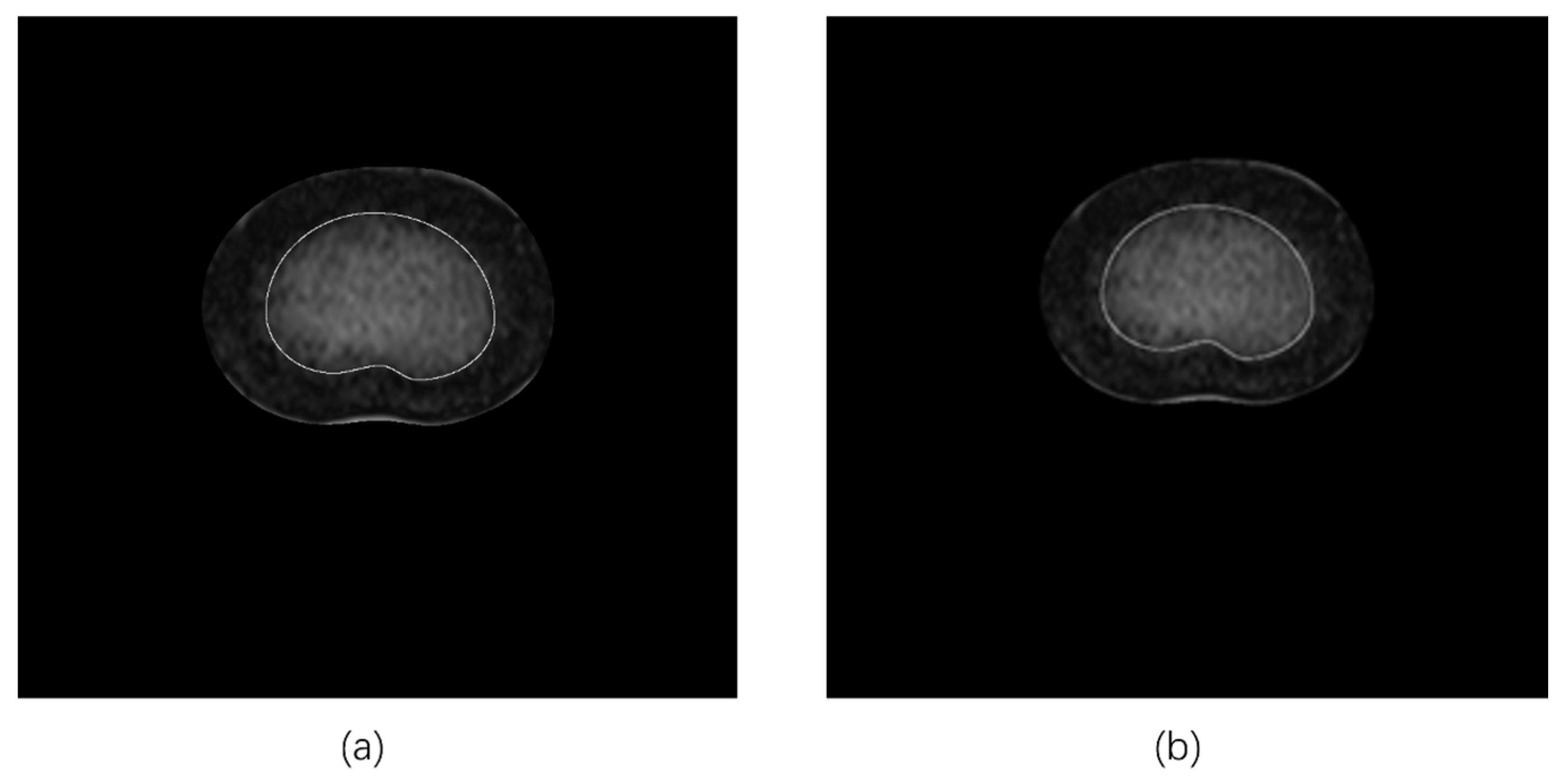 Bioengineering 11 00466 g005