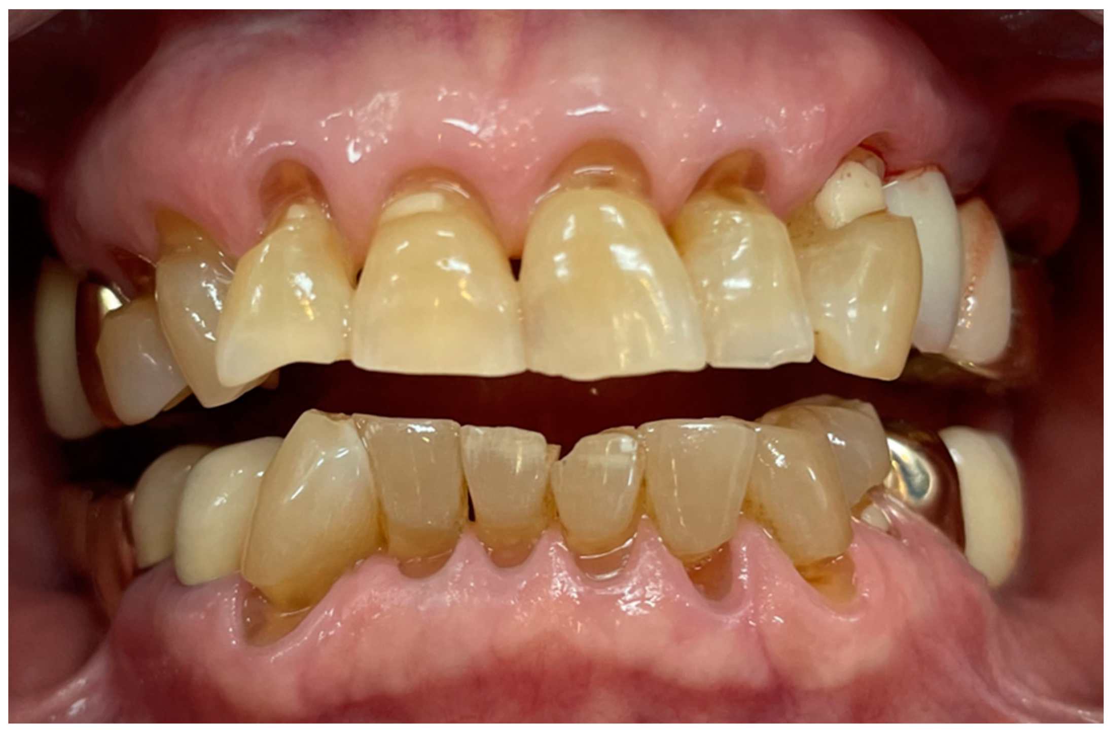 Bioengineering 11 00474 g001