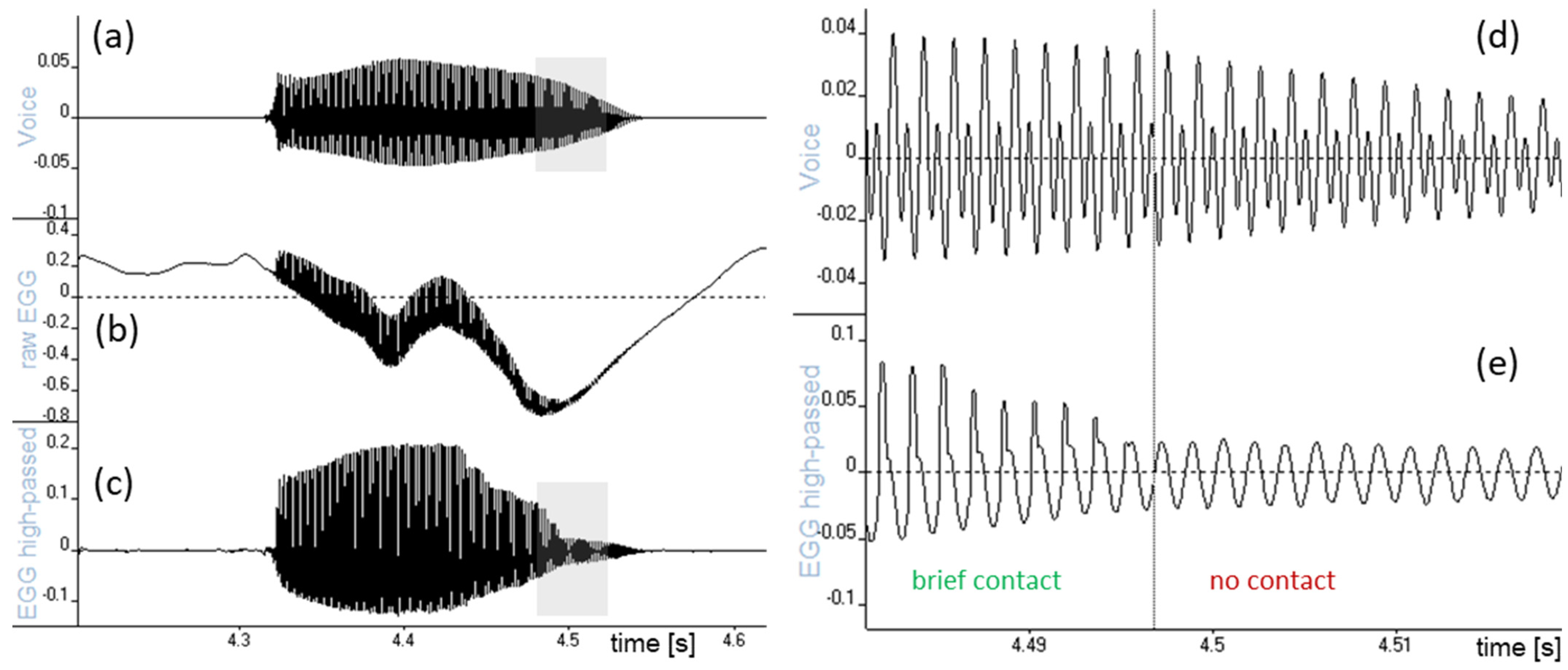 Bioengineering 11 00479 g001