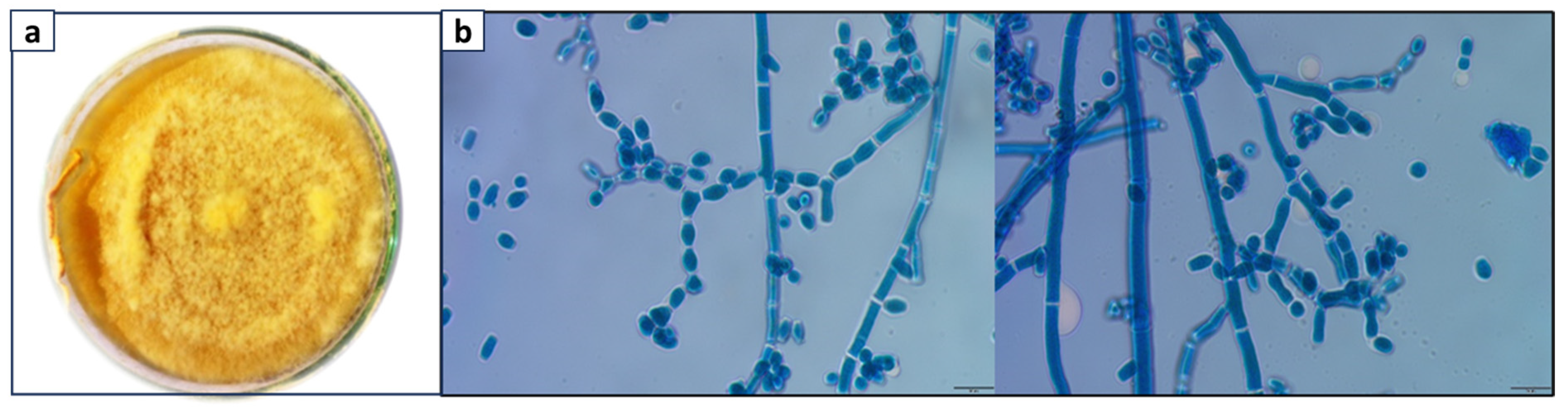 Bioengineering 11 00510 g001