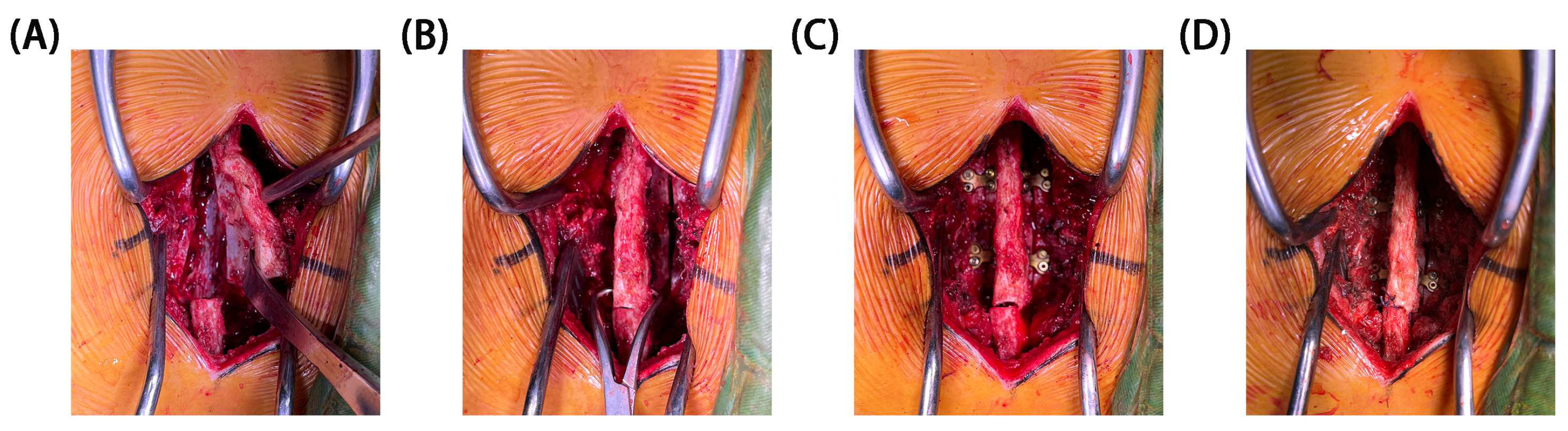 Bioengineering 11 00519 g002