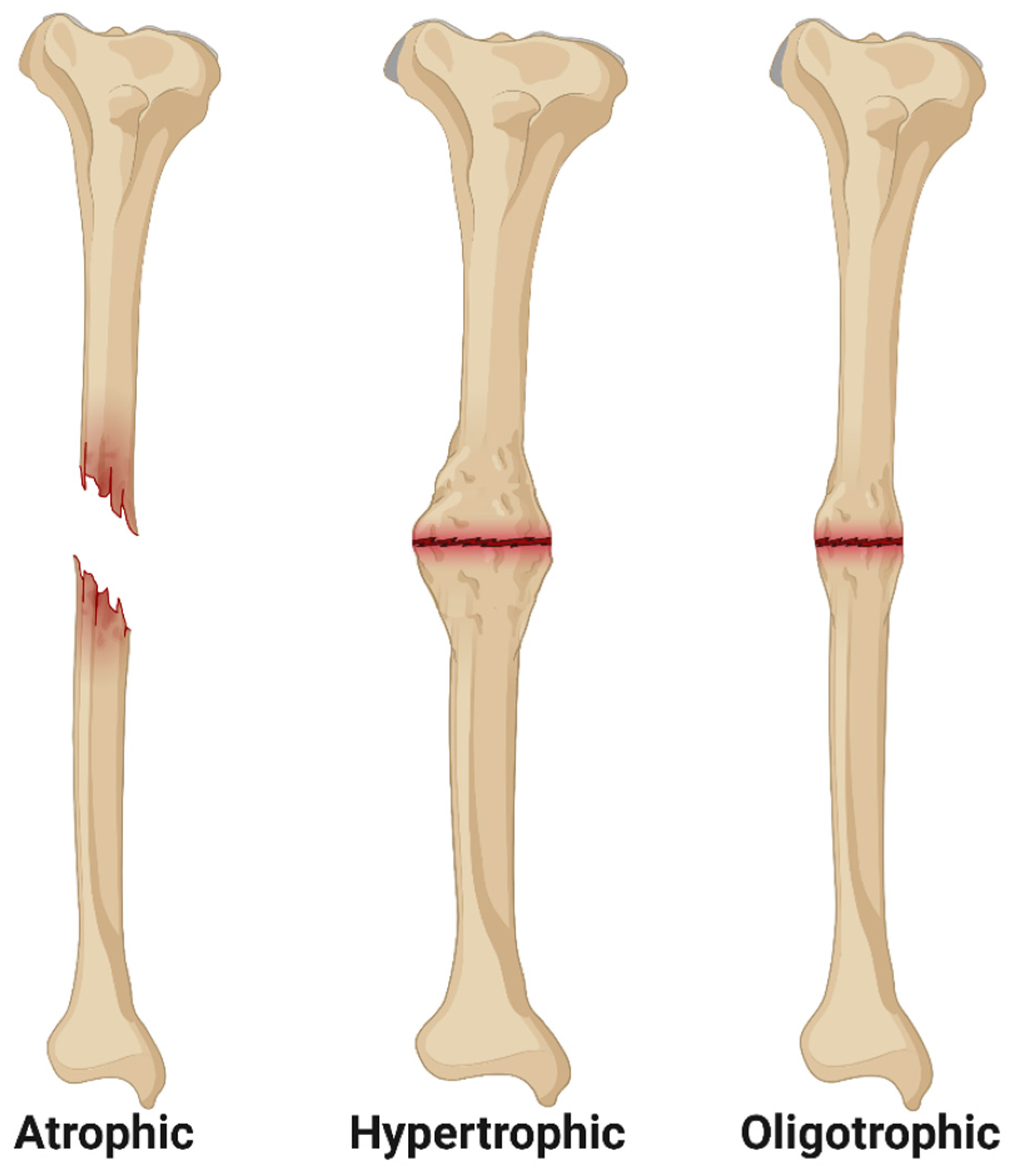 Bioengineering 11 00525 g001