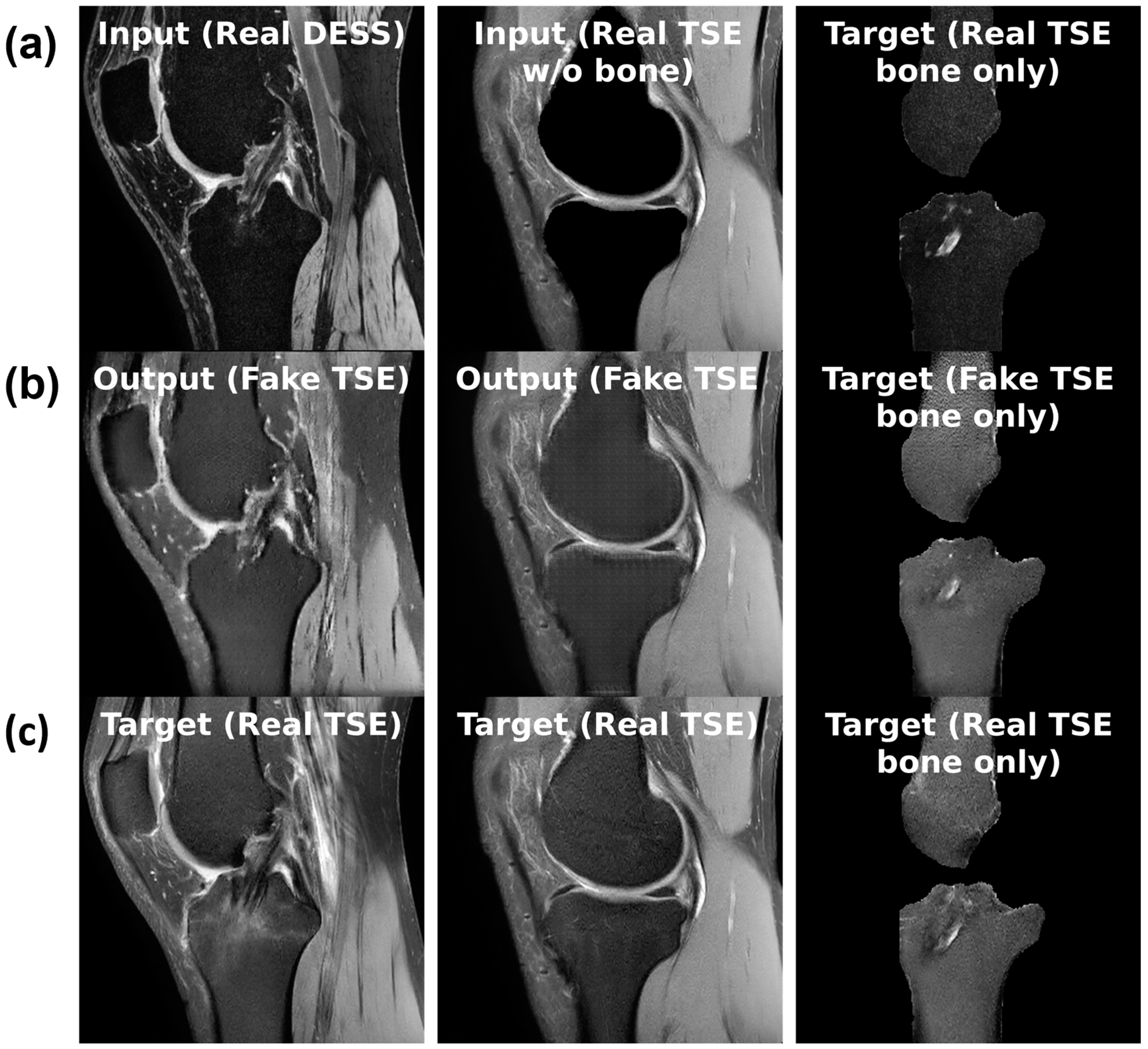 Bioengineering 11 00526 g004