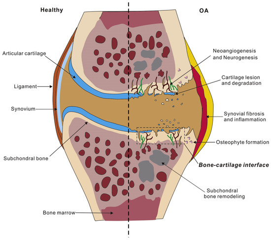 How Do Cartilage Lubrication Mechanisms Fail in Osteoarthritis? A ...