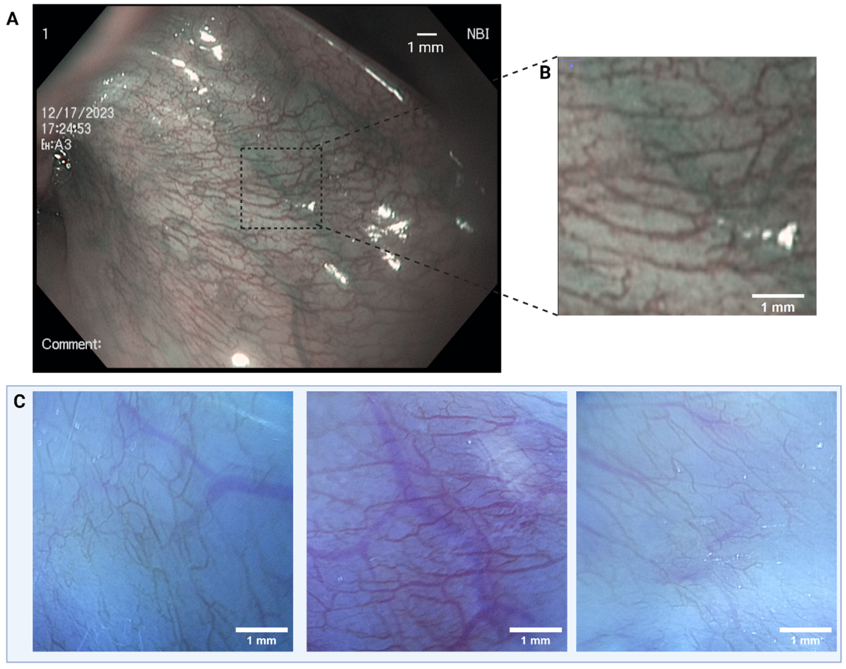 Bioengineering 11 00557 g006