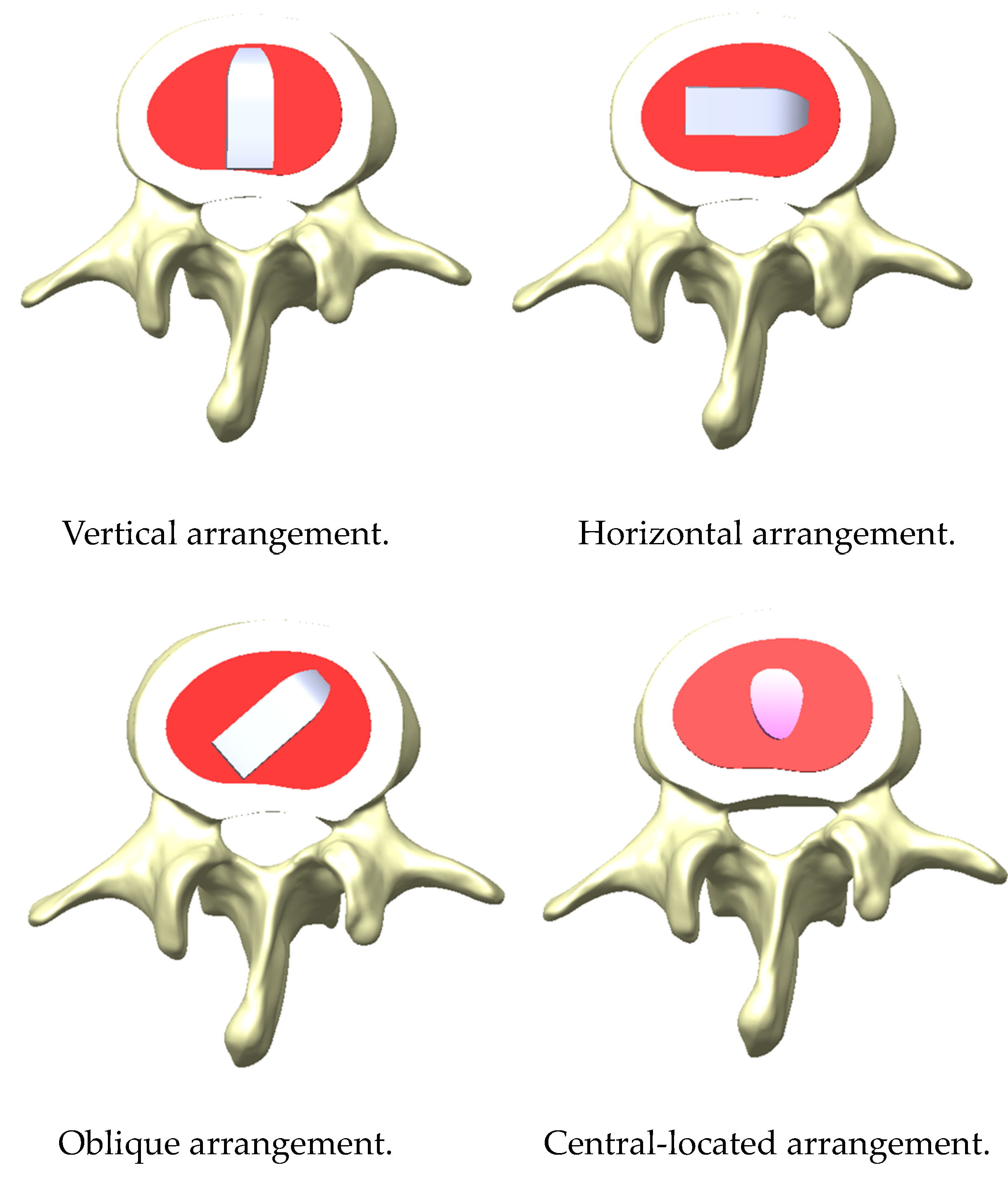 Bioengineering 11 00558 g004