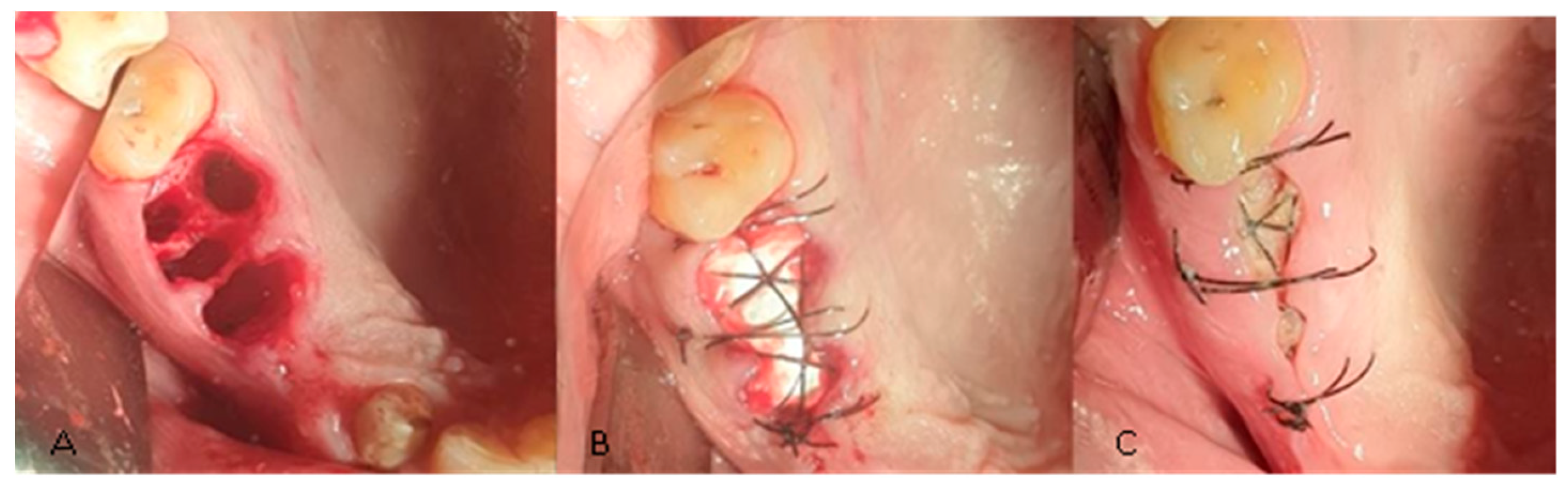 Bioengineering 11 00566 g002