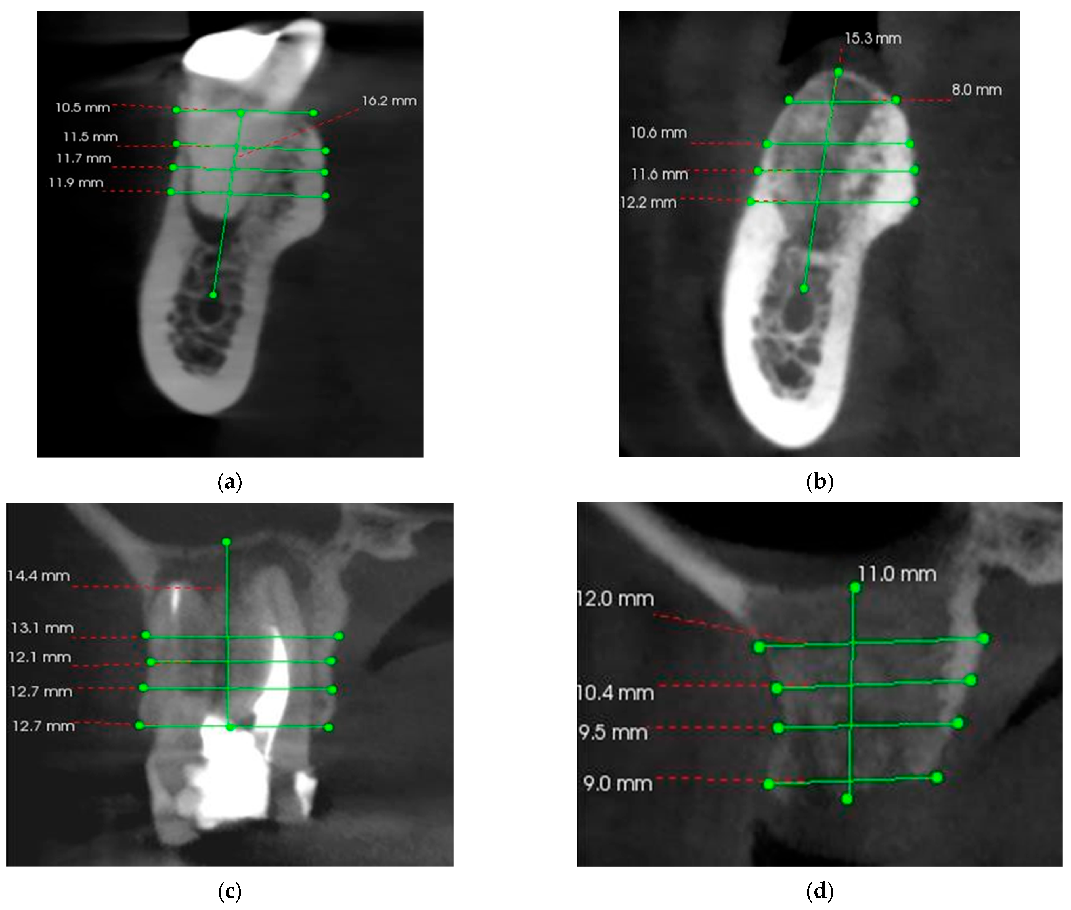 Bioengineering 11 00566 g007