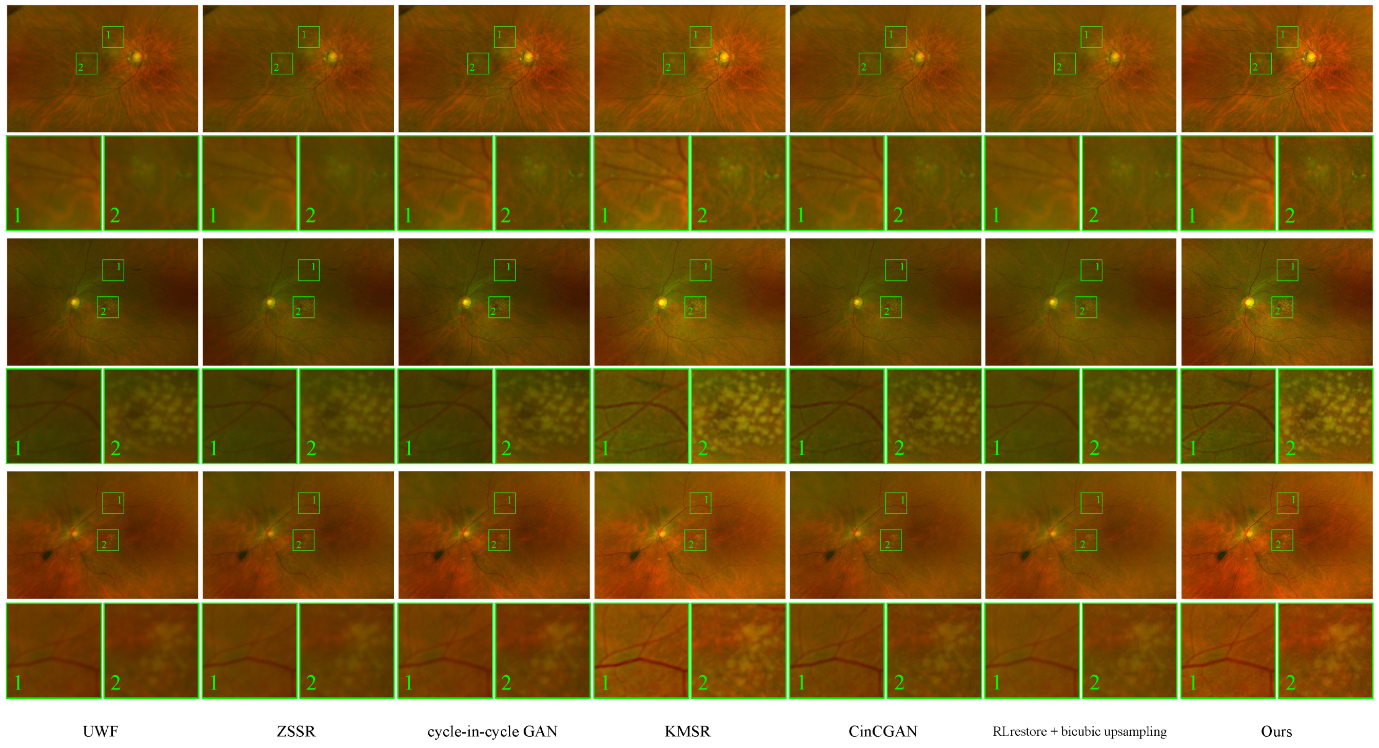 Bioengineering 11 00568 g005