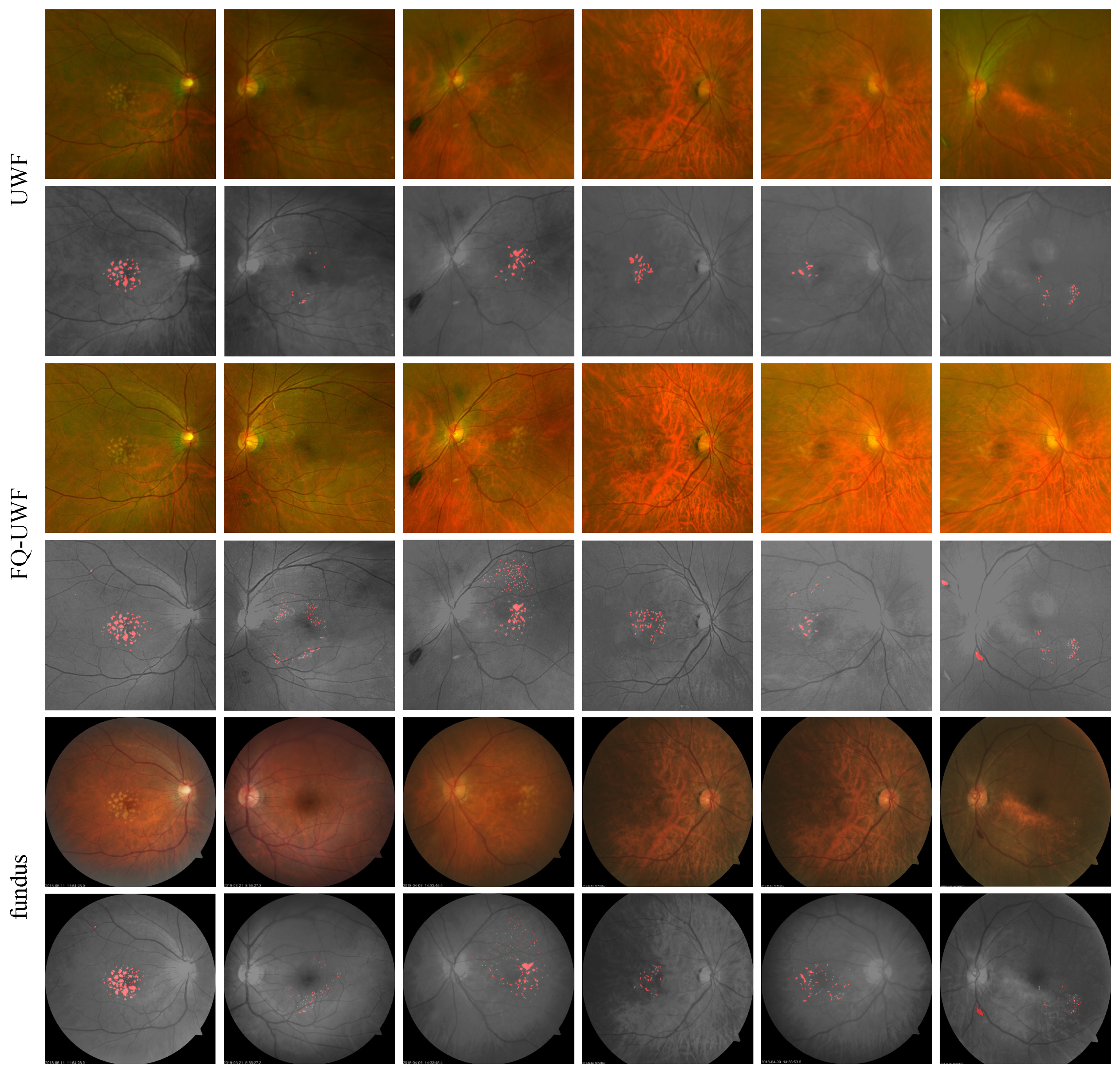 Bioengineering 11 00568 g007