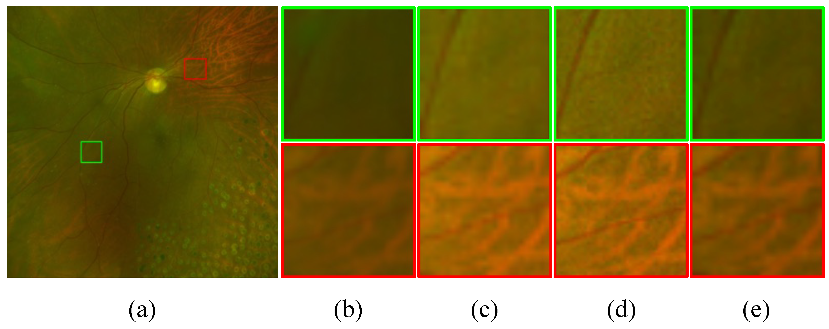 Bioengineering 11 00568 g008