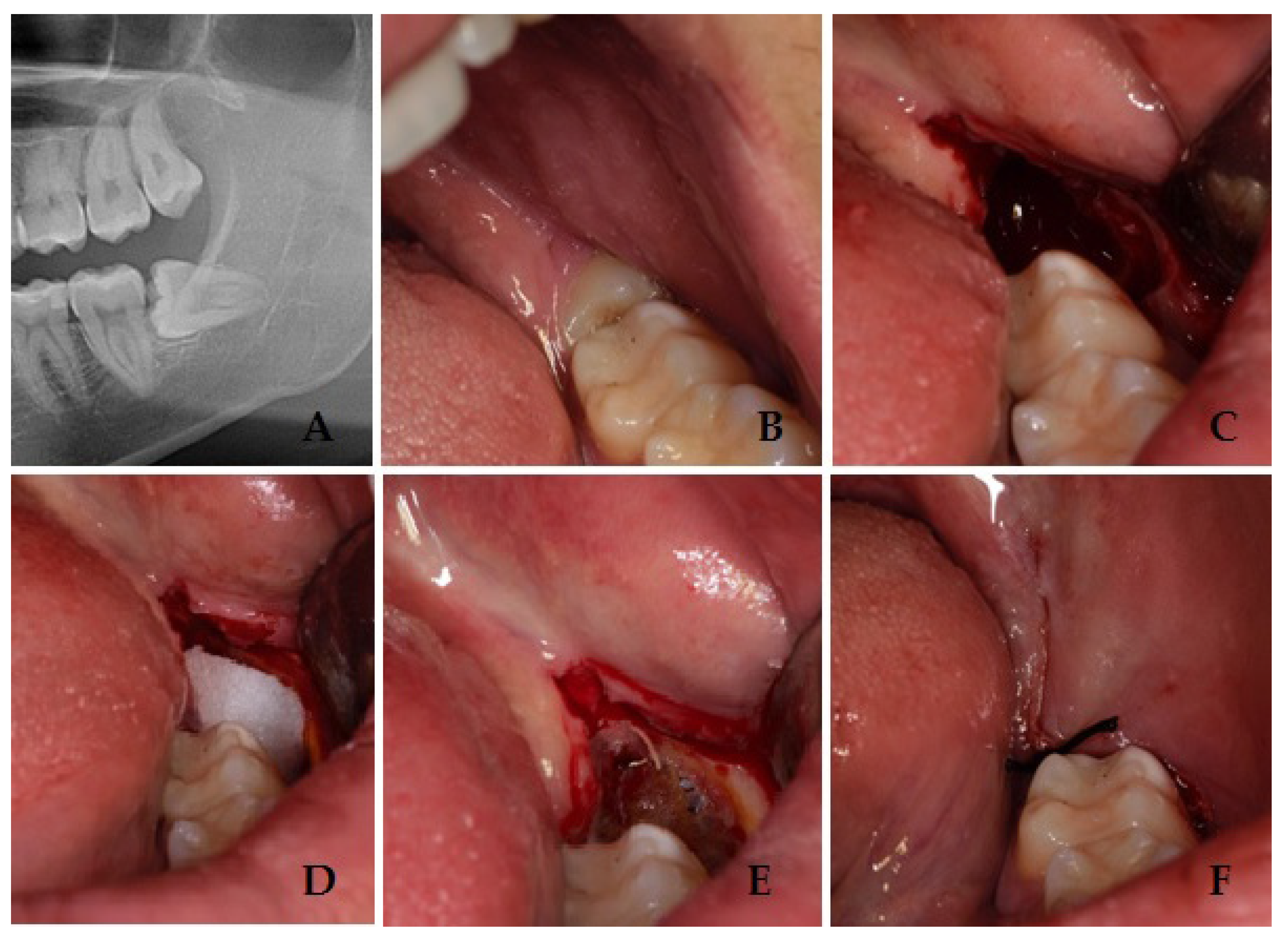 Bioengineering 11 00569 g001