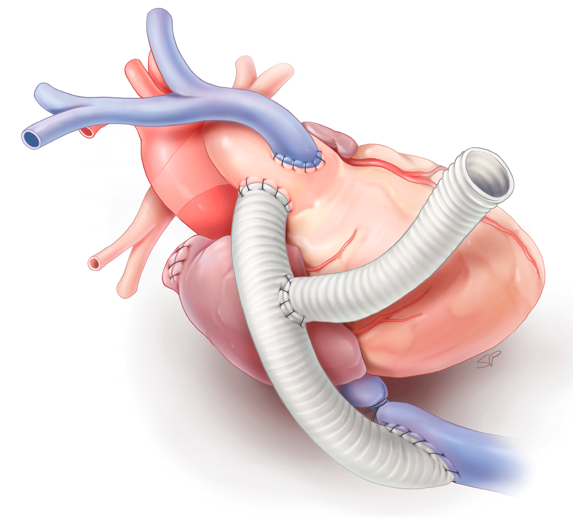 Bioengineering 11 00594 g001