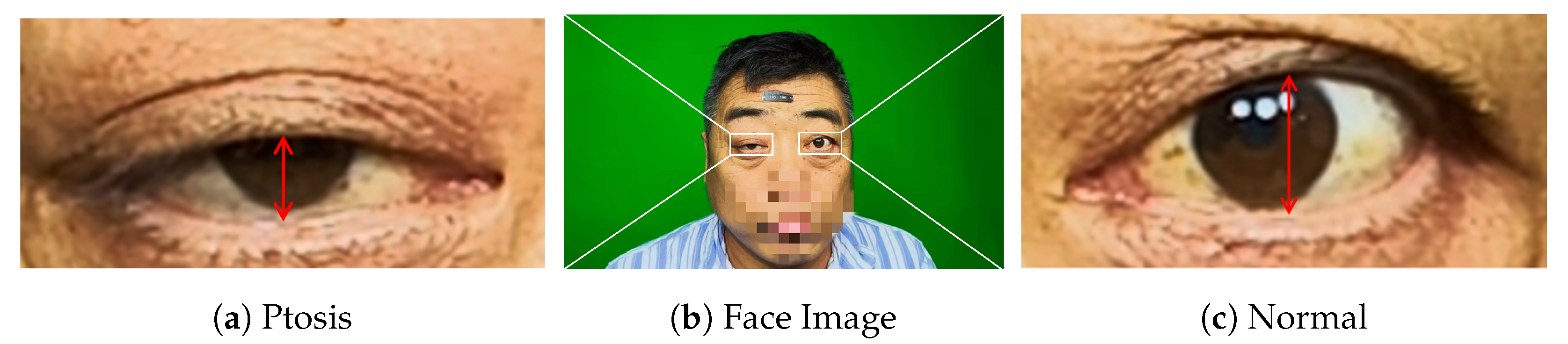 Bioengineering 11 00595 g001