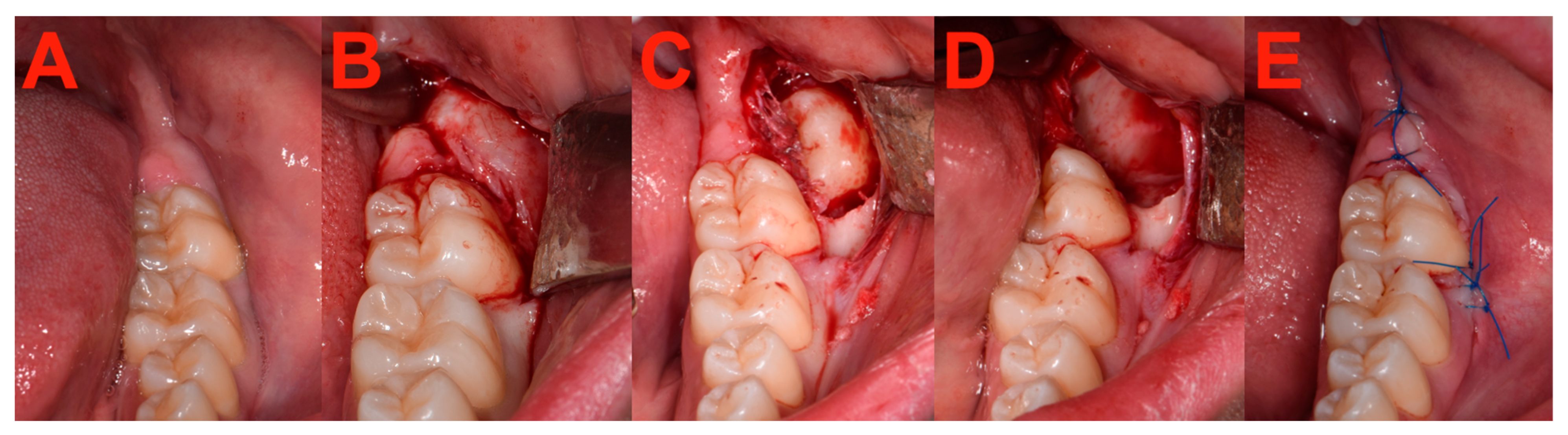 Bioengineering 11 00625 g006