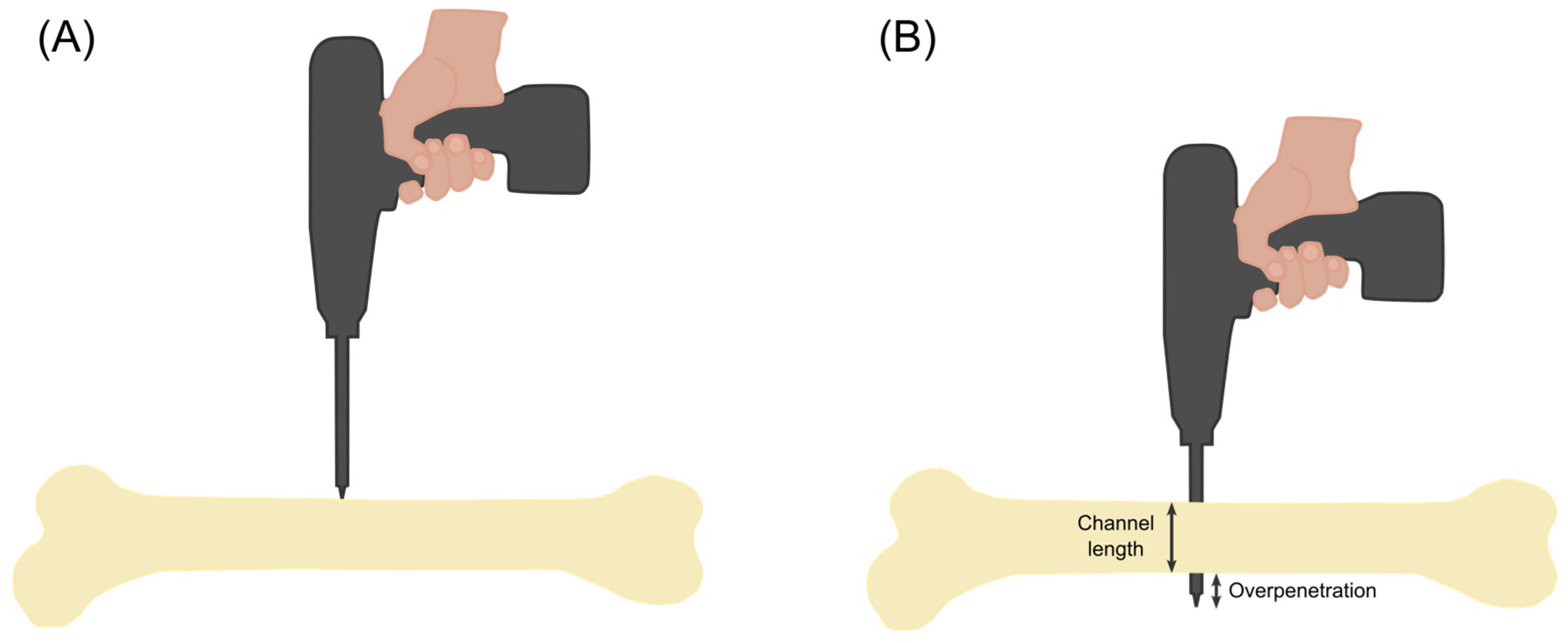 Bioengineering 11 00630 g003